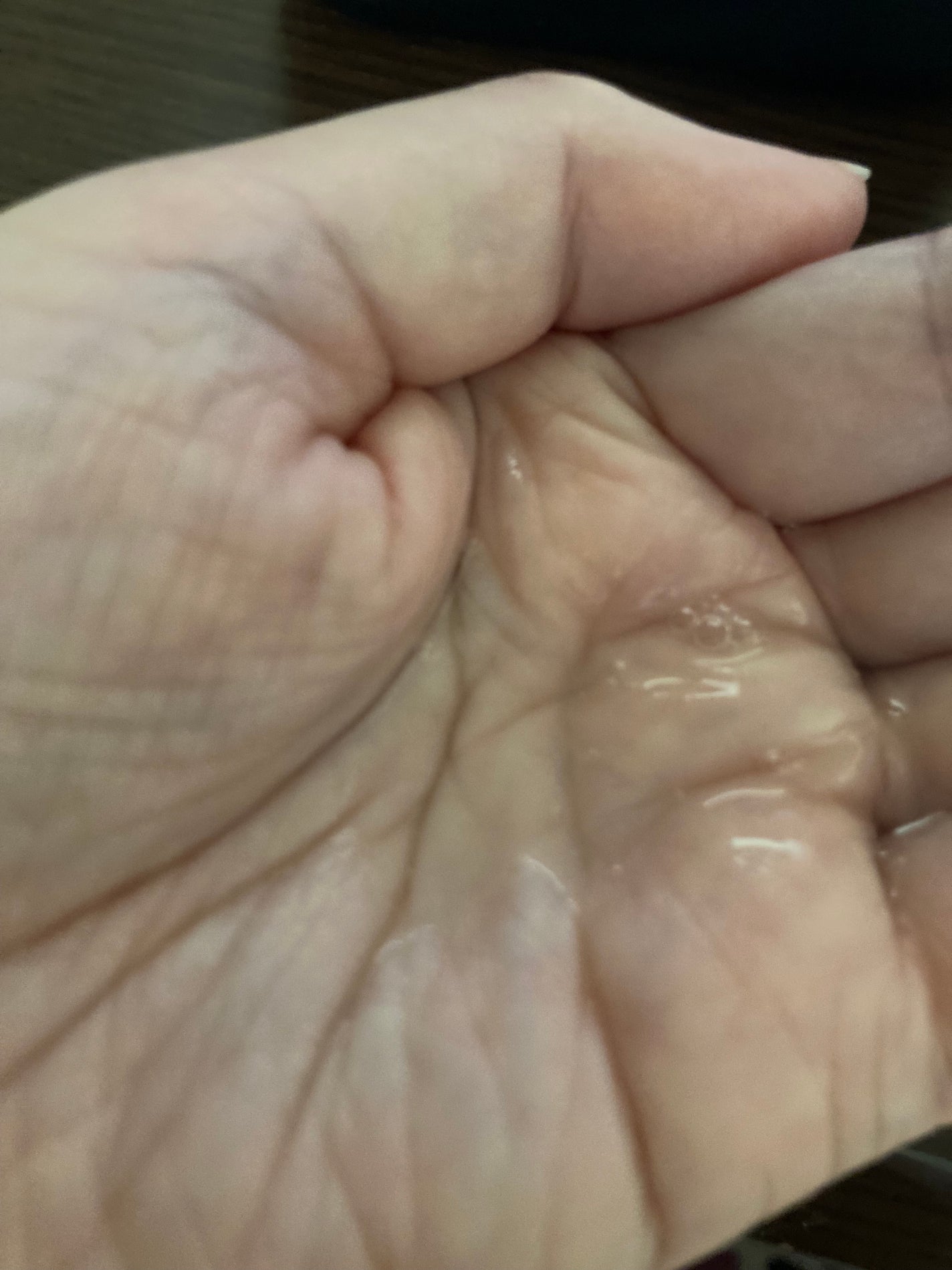 ジンクテカBセラム/BRING GREEN/美容液を使ったクチコミ(3枚目)