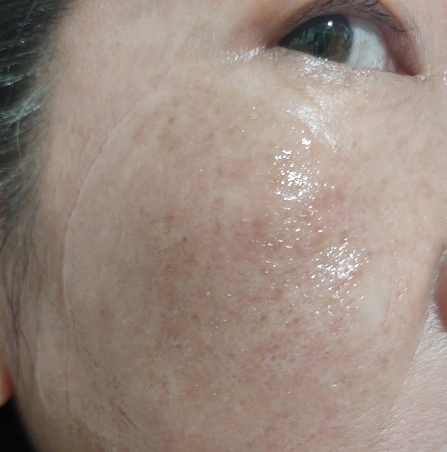 Skin Barrier Calming Lotion/Ongredients/乳液を使ったクチコミ(6枚目)