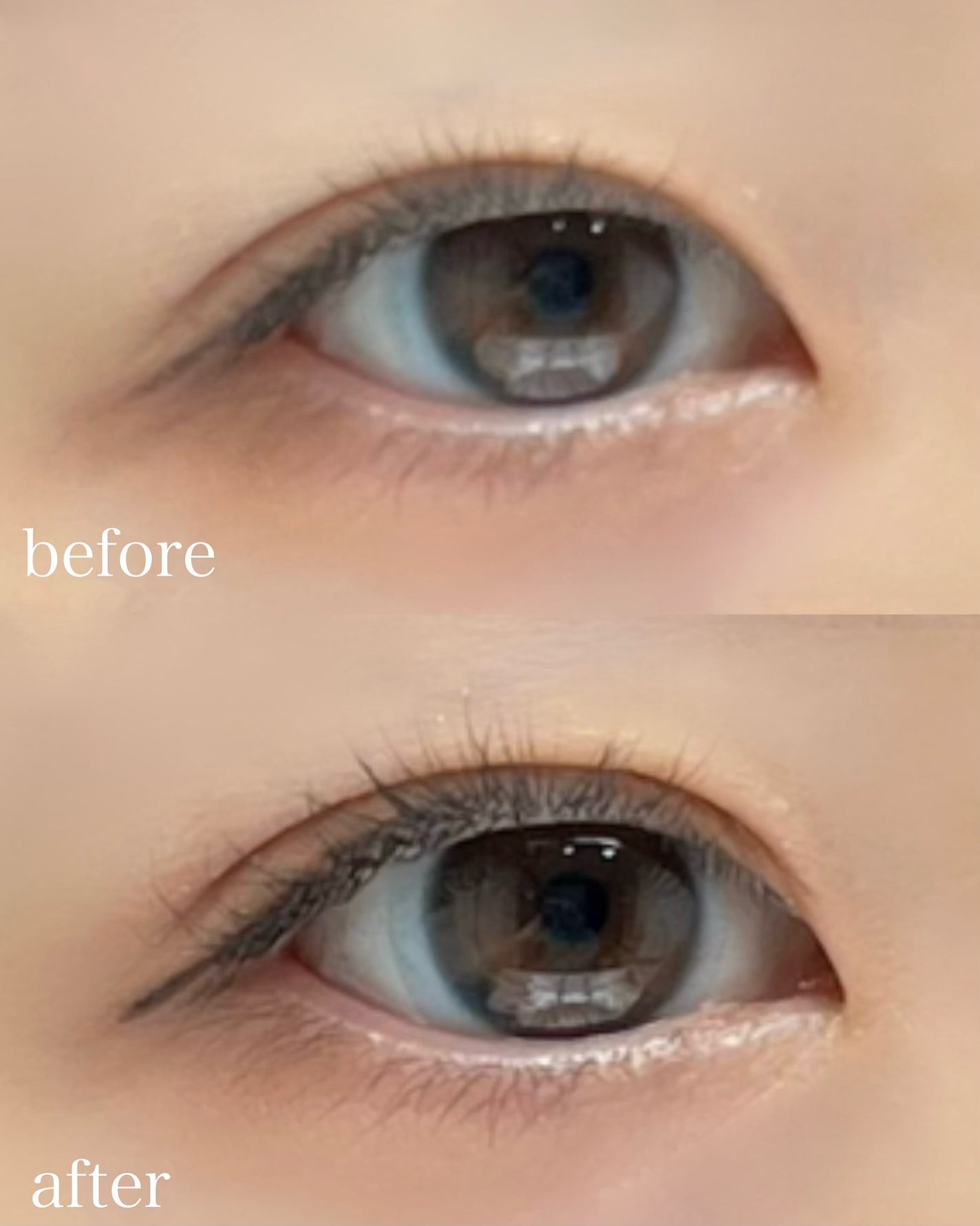 メザイク イージークリア 接着クリアタイプ/メザイク/二重まぶた用アイテムを使ったクチコミ(4枚目)