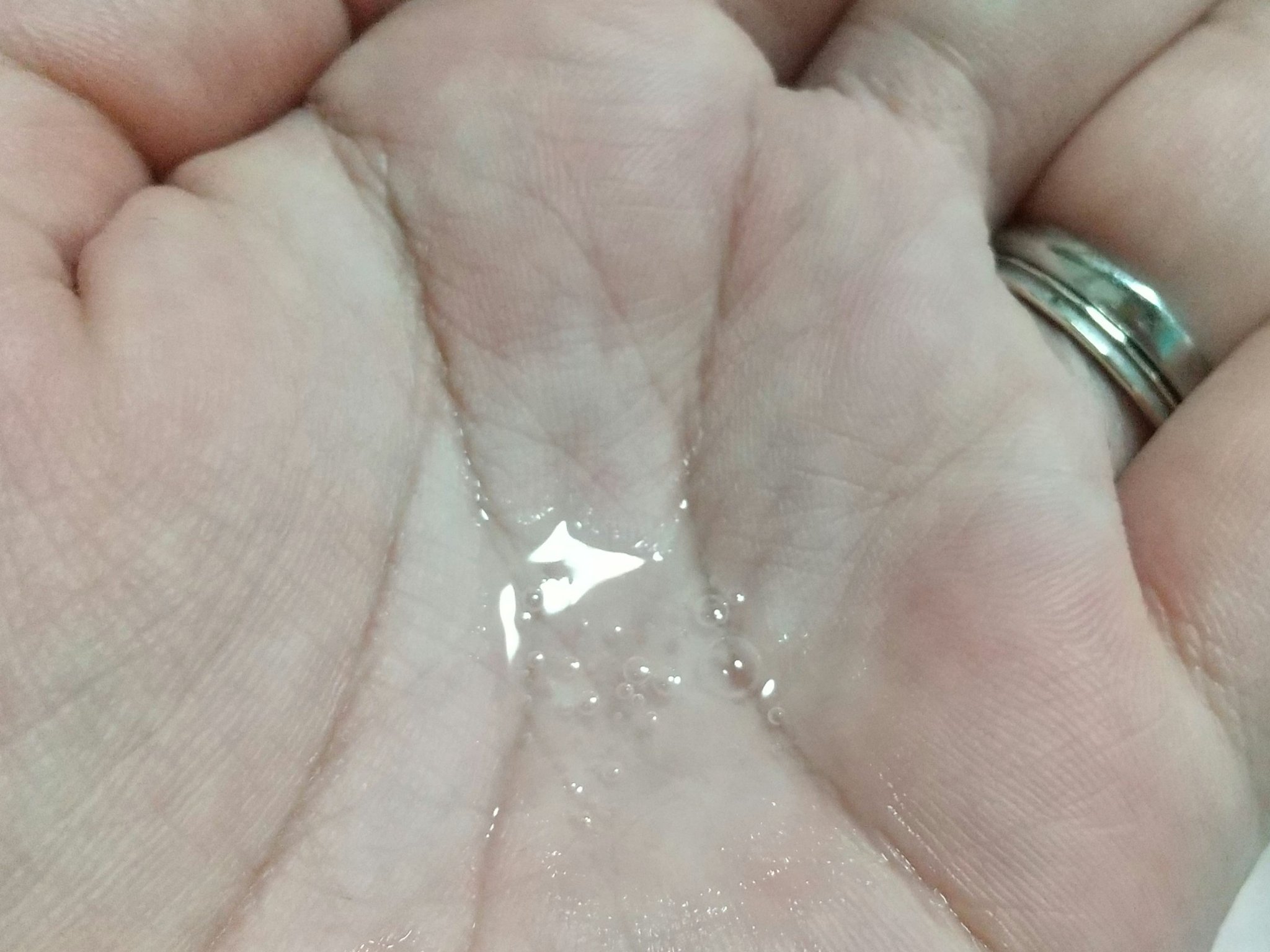 カプチュール トータル インテンシブ エッセンス ローション/Dior/化粧水を使ったクチコミ（3枚目）