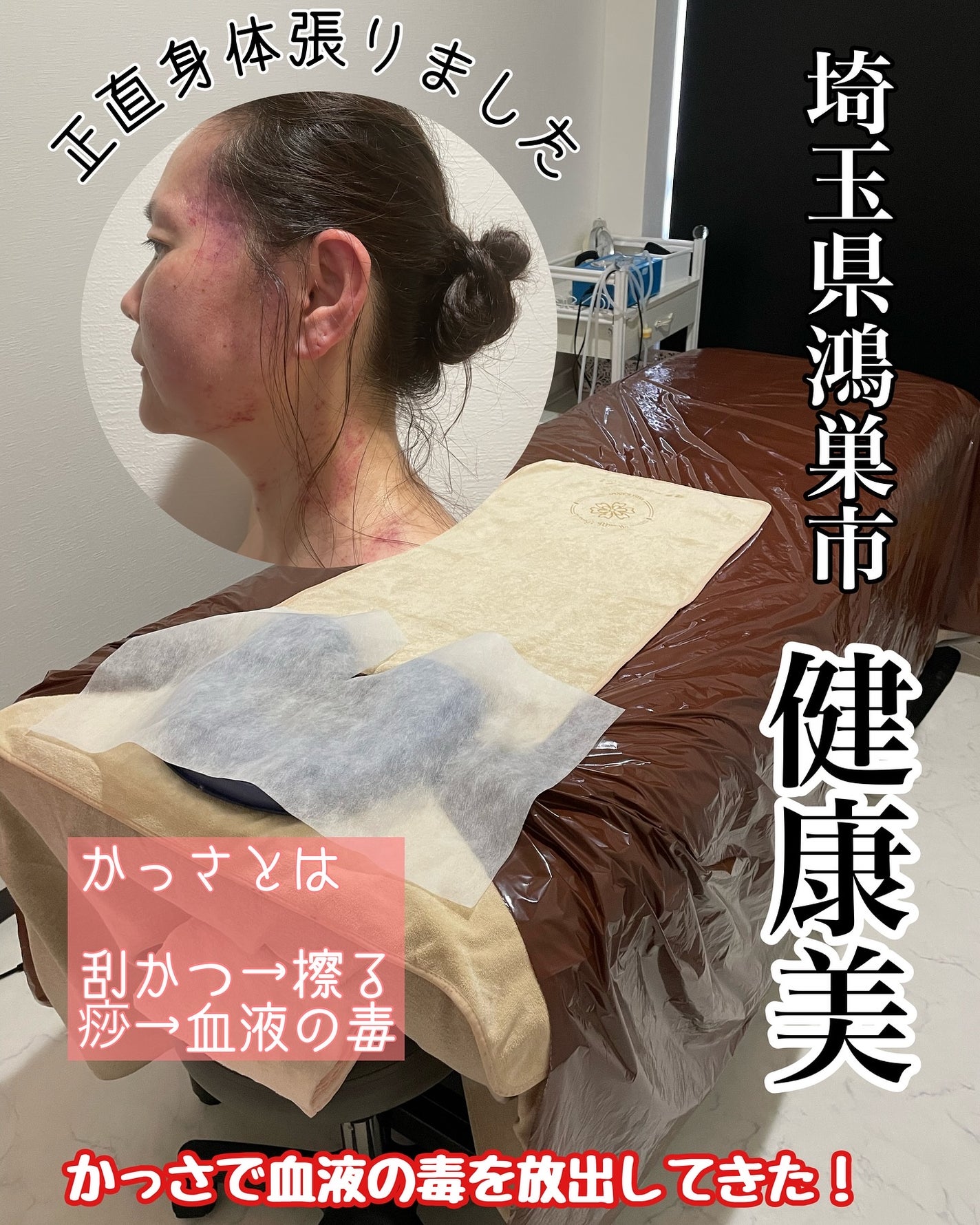 しのち☀️ on LIPS 「全国8人くらいのしのちビューティーファンの皆さまごきげんよう過..」(1枚目)