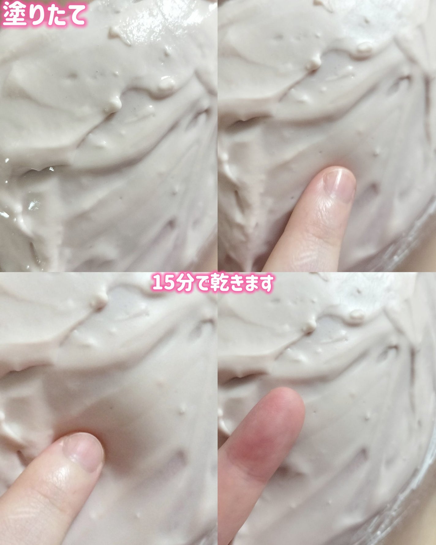 メディヒールダーマモデリングパックコラーゲン/MEDIHEAL/シートマスク・パックを使ったクチコミ(5枚目)