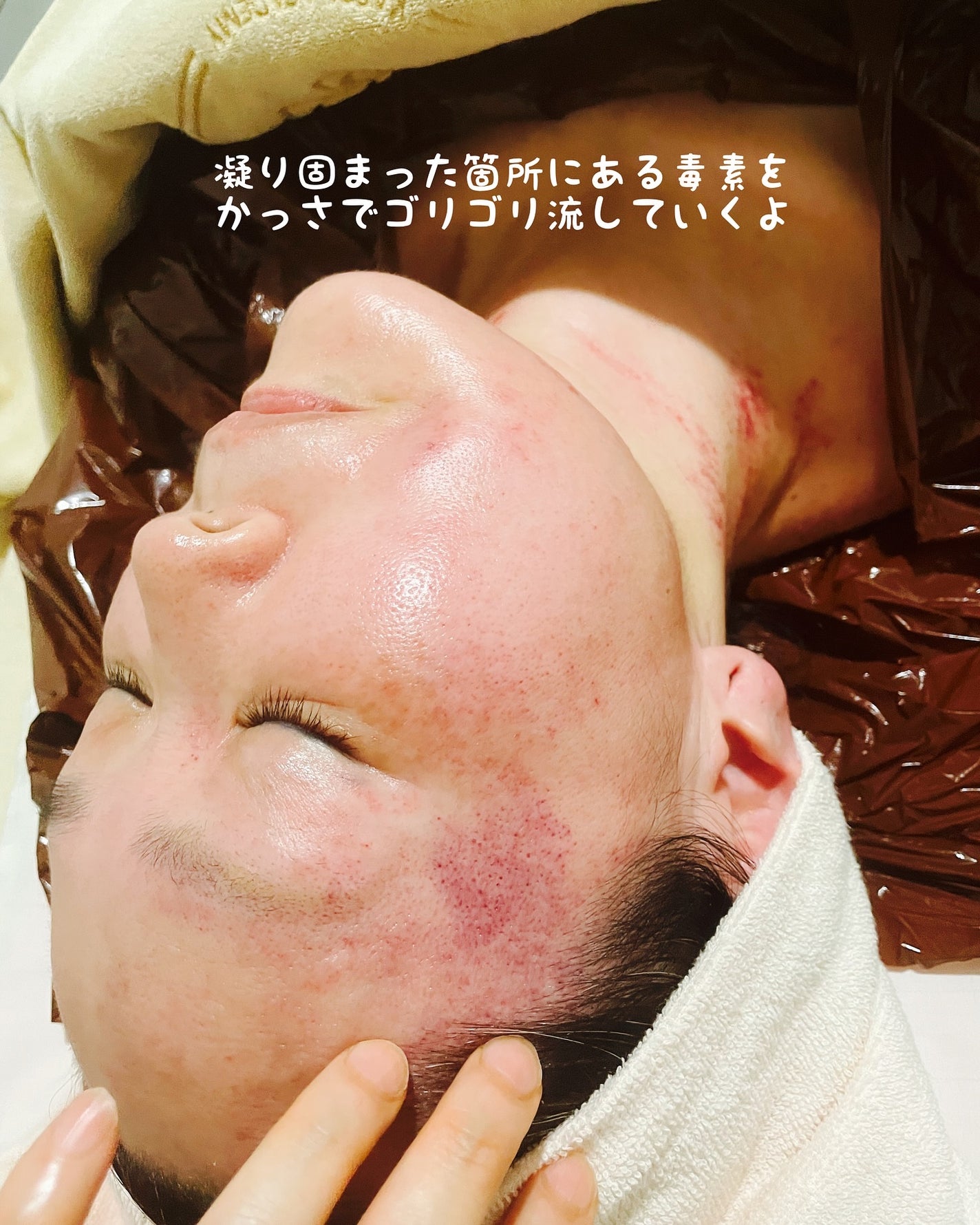 しのち☀️ on LIPS 「全国8人くらいのしのちビューティーファンの皆さまごきげんよう過..」(6枚目)