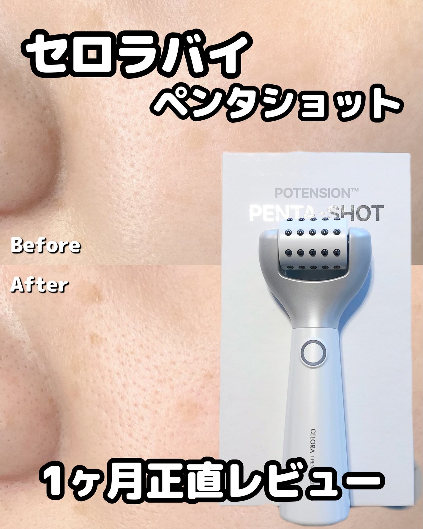 ペンタショット/CELORABY/美顔器・マッサージを使ったクチコミ(1枚目)