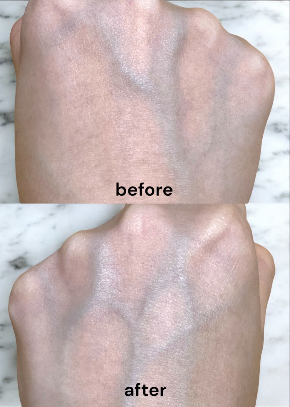 RXザ・アルファアルブチン2 ニキビ跡ケアセラム/COSRX/美容液を使ったクチコミ（3枚目）