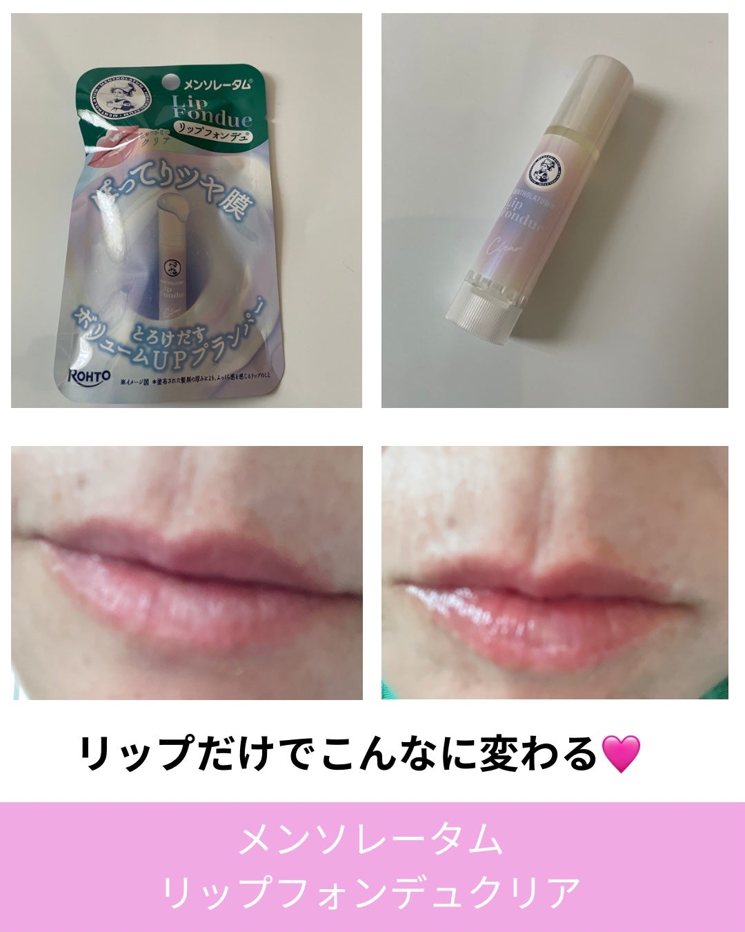 コスメ大好きフォロバ100 on LIPS 「⸻ロート製薬様からいただきました🫧#本音レビュー_リップフォン..」(3枚目)