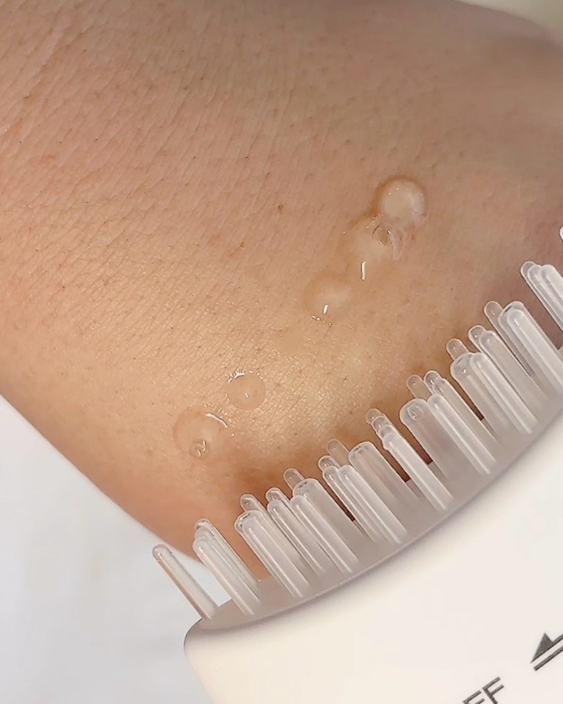 グローターンヘアアンプル/リリーイブ/頭皮ローションを使ったクチコミ(5枚目)