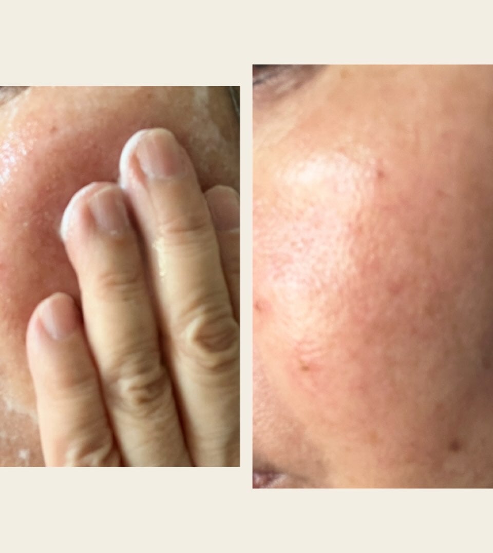 ブライトCO2フェイスパック/BORDER FREE cosmetics/洗い流すパック・マスクを使ったクチコミ(5枚目)