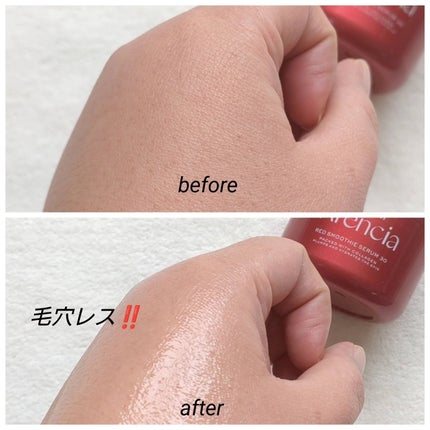 レッドモチセラム30/アレンシア/美容液を使ったクチコミ(6枚目)