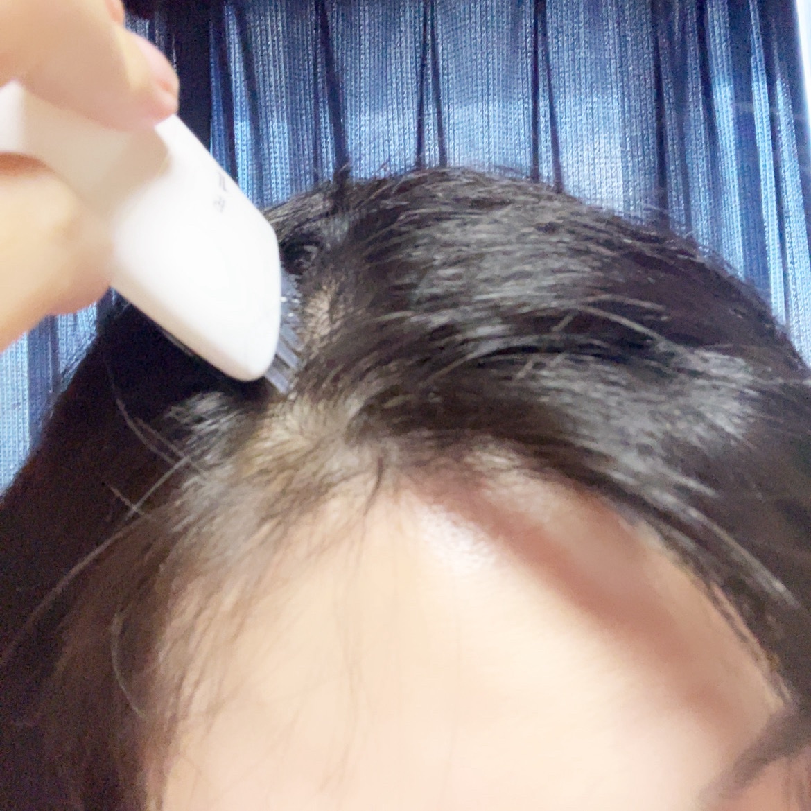 グローターンヘアアンプル/リリーイブ/頭皮ローションを使ったクチコミ（3枚目）