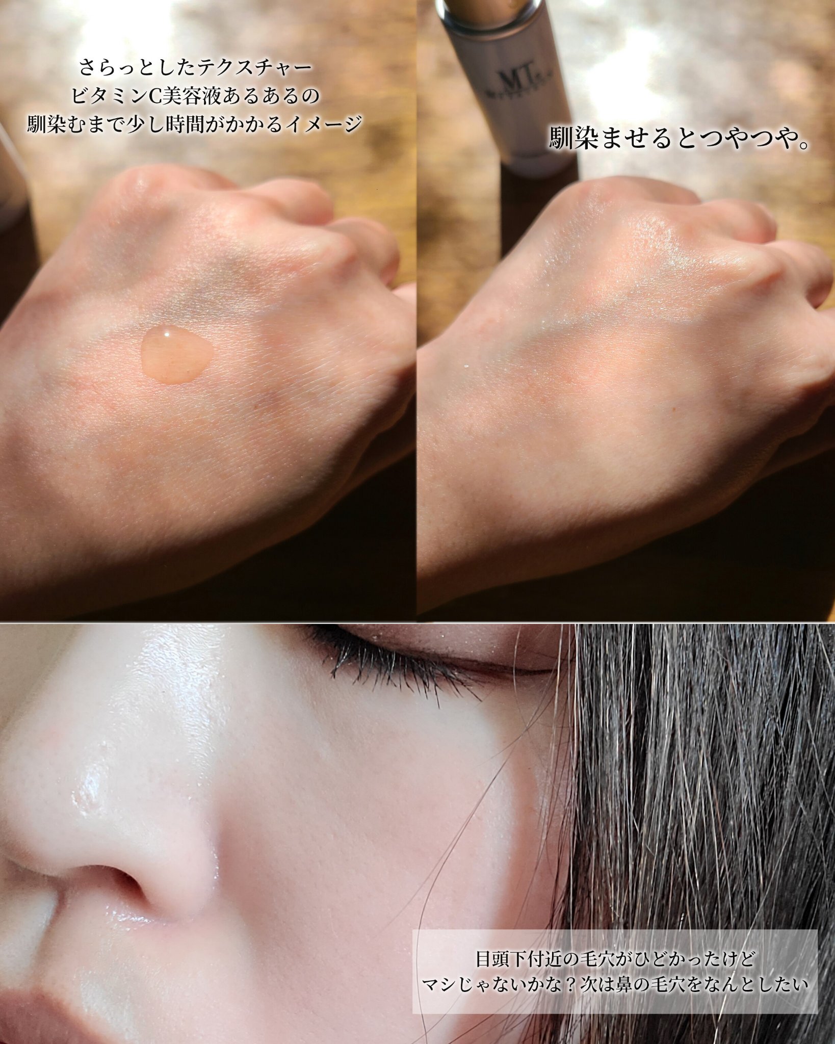 MT コンデンスCセラム/MTメタトロン/美容液を使ったクチコミ（3枚目）