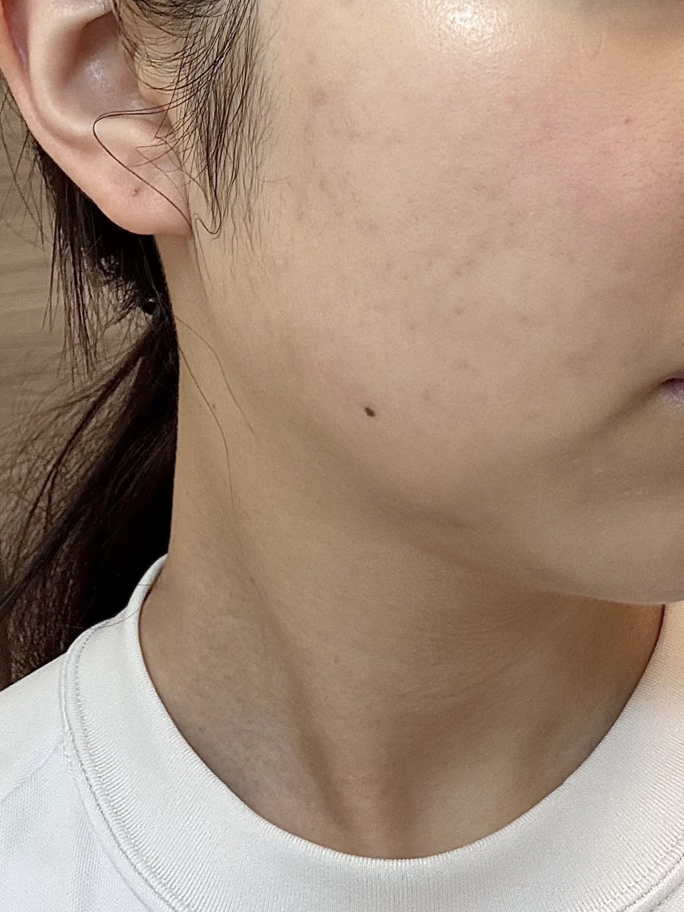 薬用しみ集中対策 プレミアム美容液/メラノCC/美容液を使ったクチコミ（1枚目）