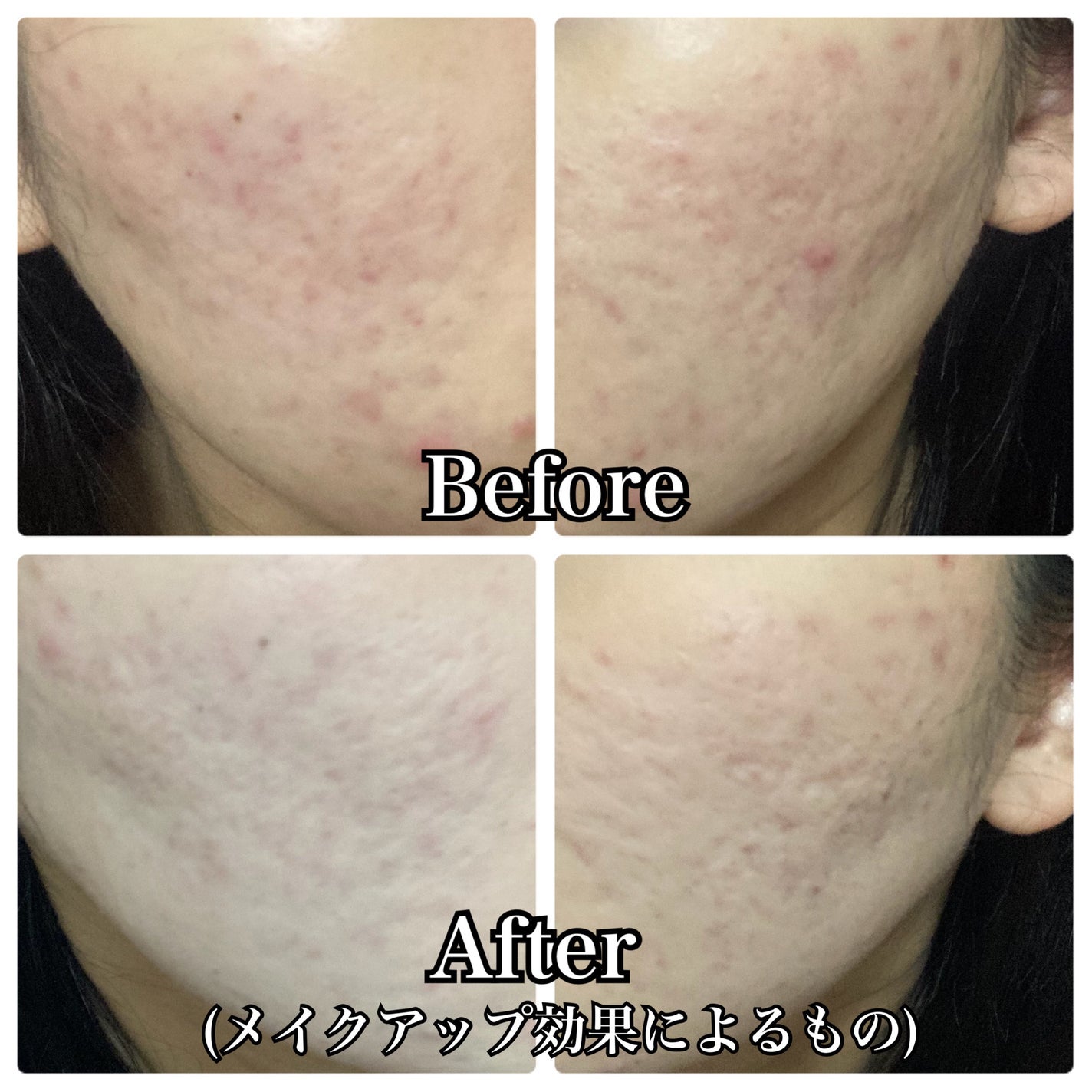 スノービューティー ブライトニング スキンケアパウダーA 2025/スノービューティー/プレストパウダーを使ったクチコミ(8枚目)