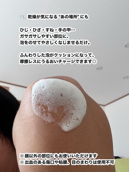 へパロイド泡フォーム(第2類医薬品)/DISM/フェイスクリームを使ったクチコミ(3枚目)