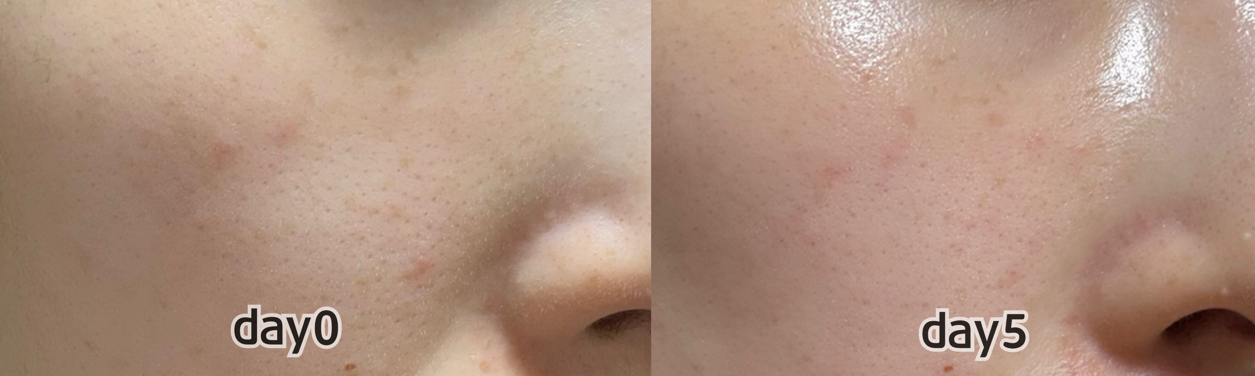 ビタ3セラム/オーズナリー/美容液を使ったクチコミ（2枚目）