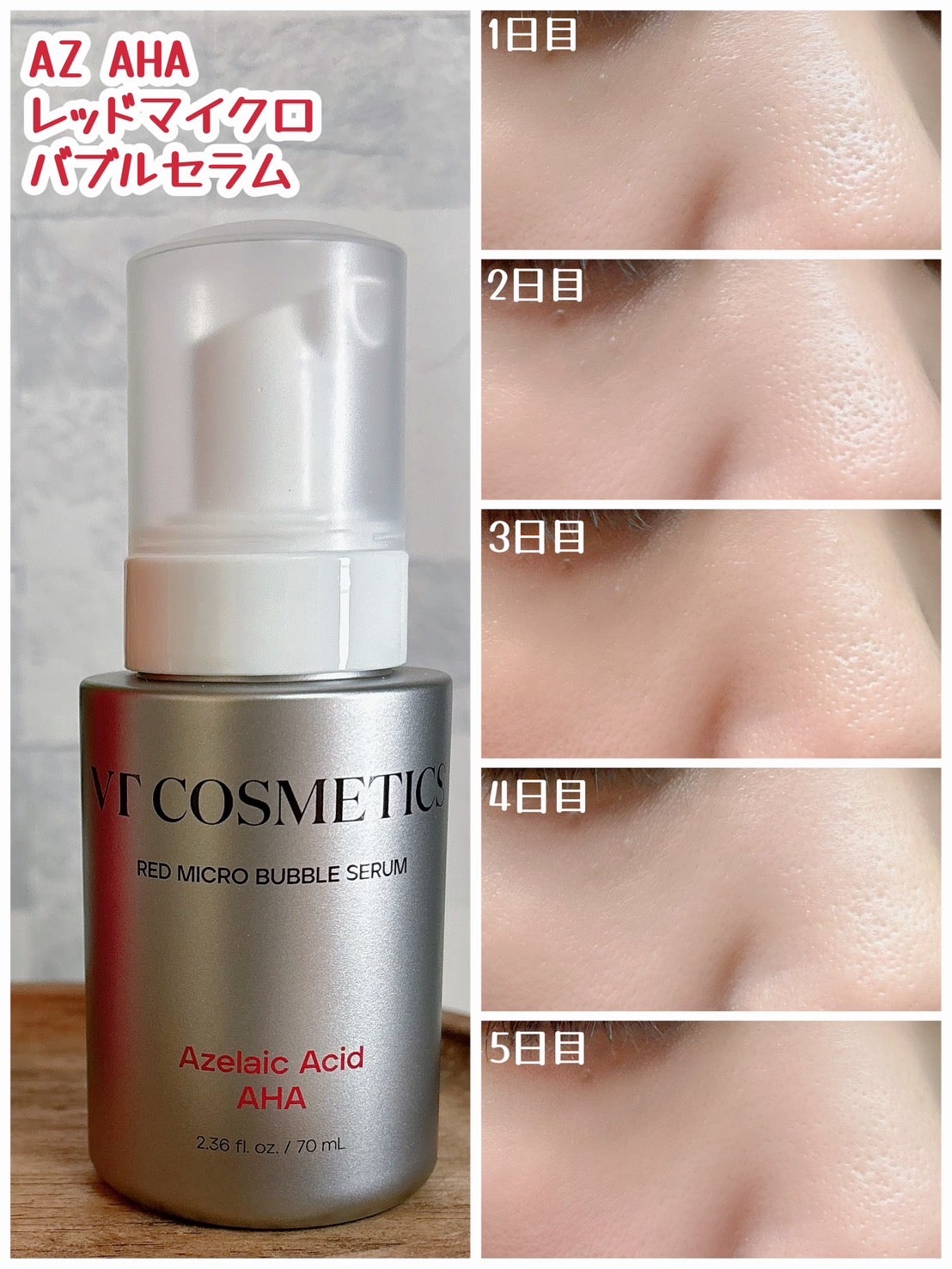 PDRN ヒアルロン酸 ミントマイクロバブルセラム/VT/美容液を使ったクチコミ(3枚目)