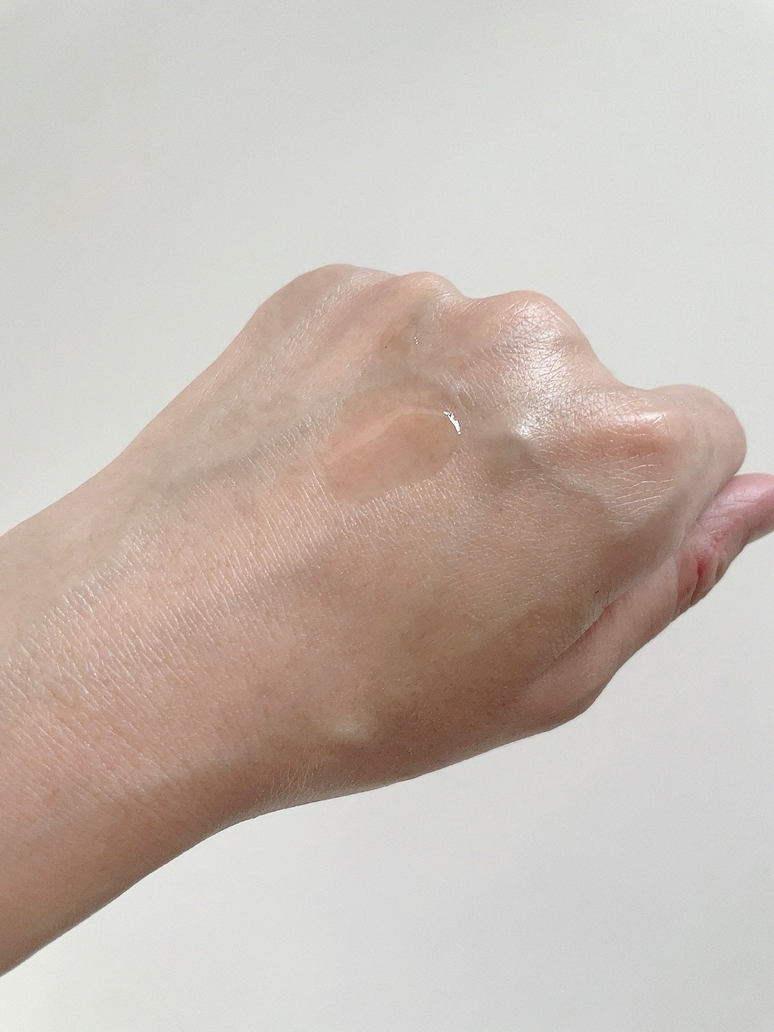 RXザ・アルファアルブチン2 ニキビ跡ケアセラム/COSRX/美容液を使ったクチコミ(4枚目)