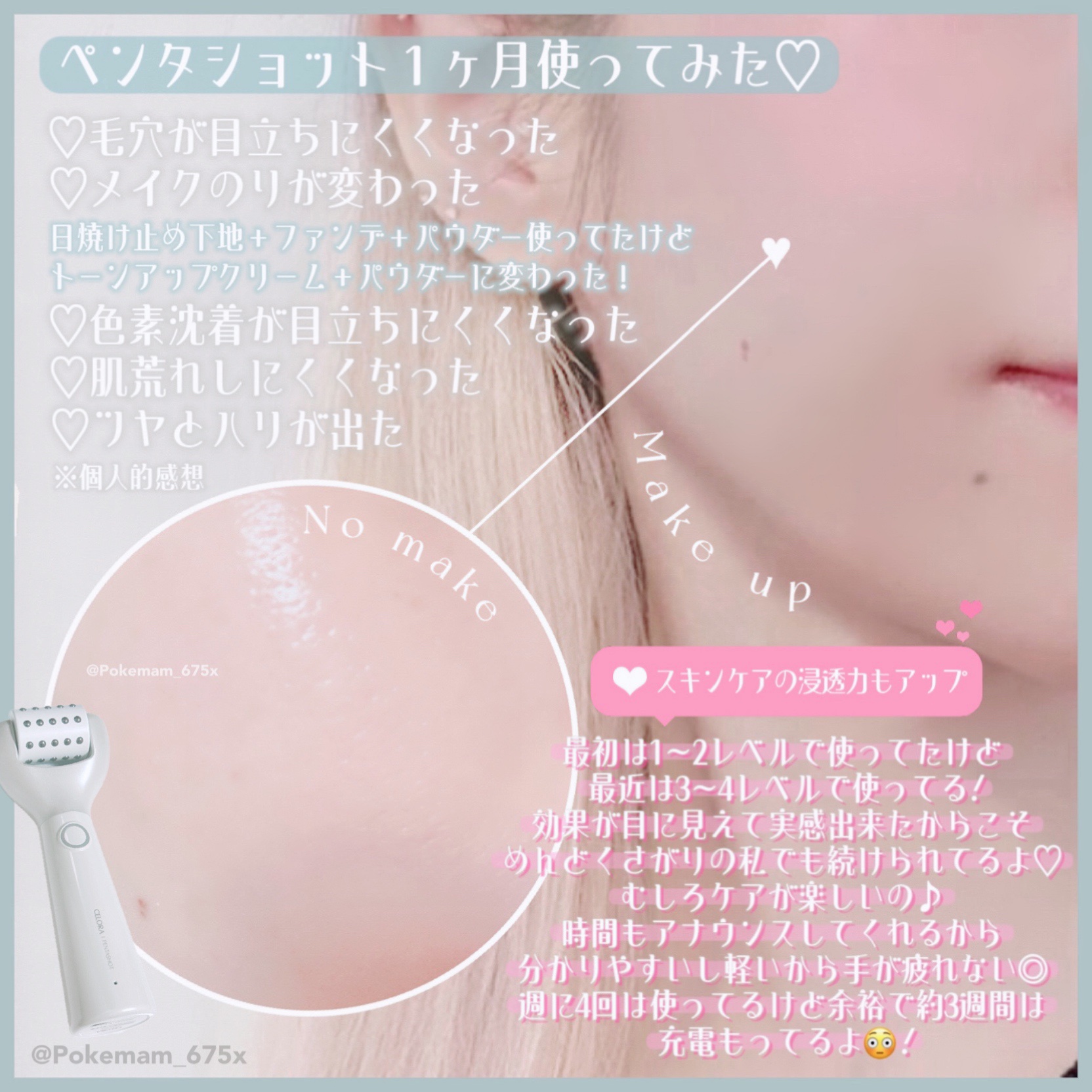 ペンタショット/CELORABY/美顔器・マッサージを使ったクチコミ（2枚目）