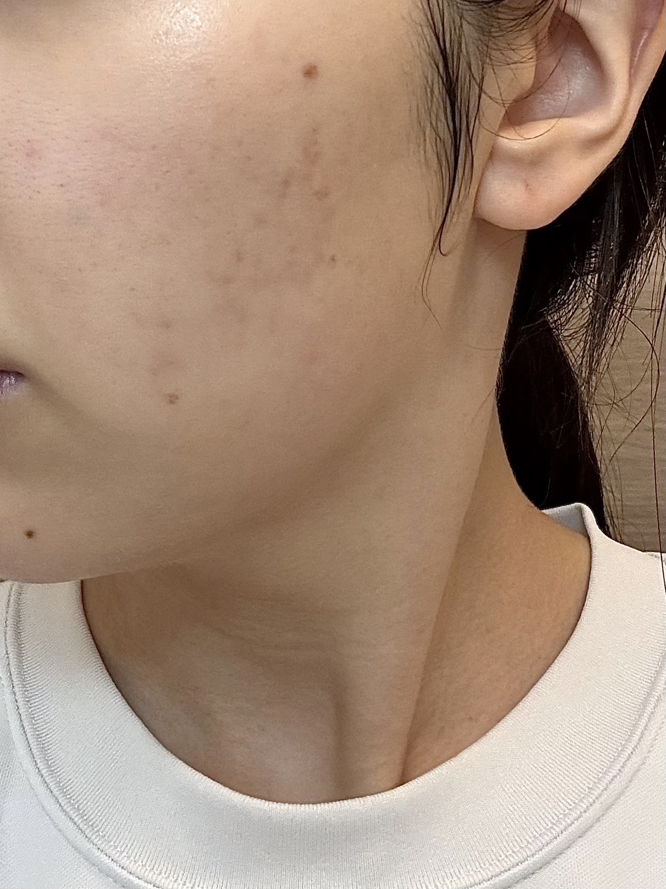 薬用しみ集中対策 プレミアム美容液/メラノCC/美容液を使ったクチコミ（2枚目）