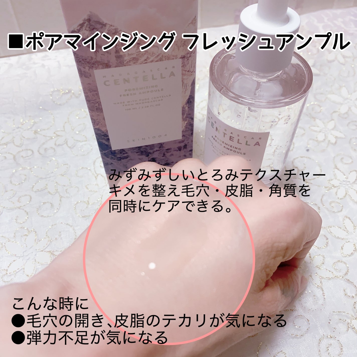 センテラ アンプル/SKIN1004/美容液を使ったクチコミ(6枚目)