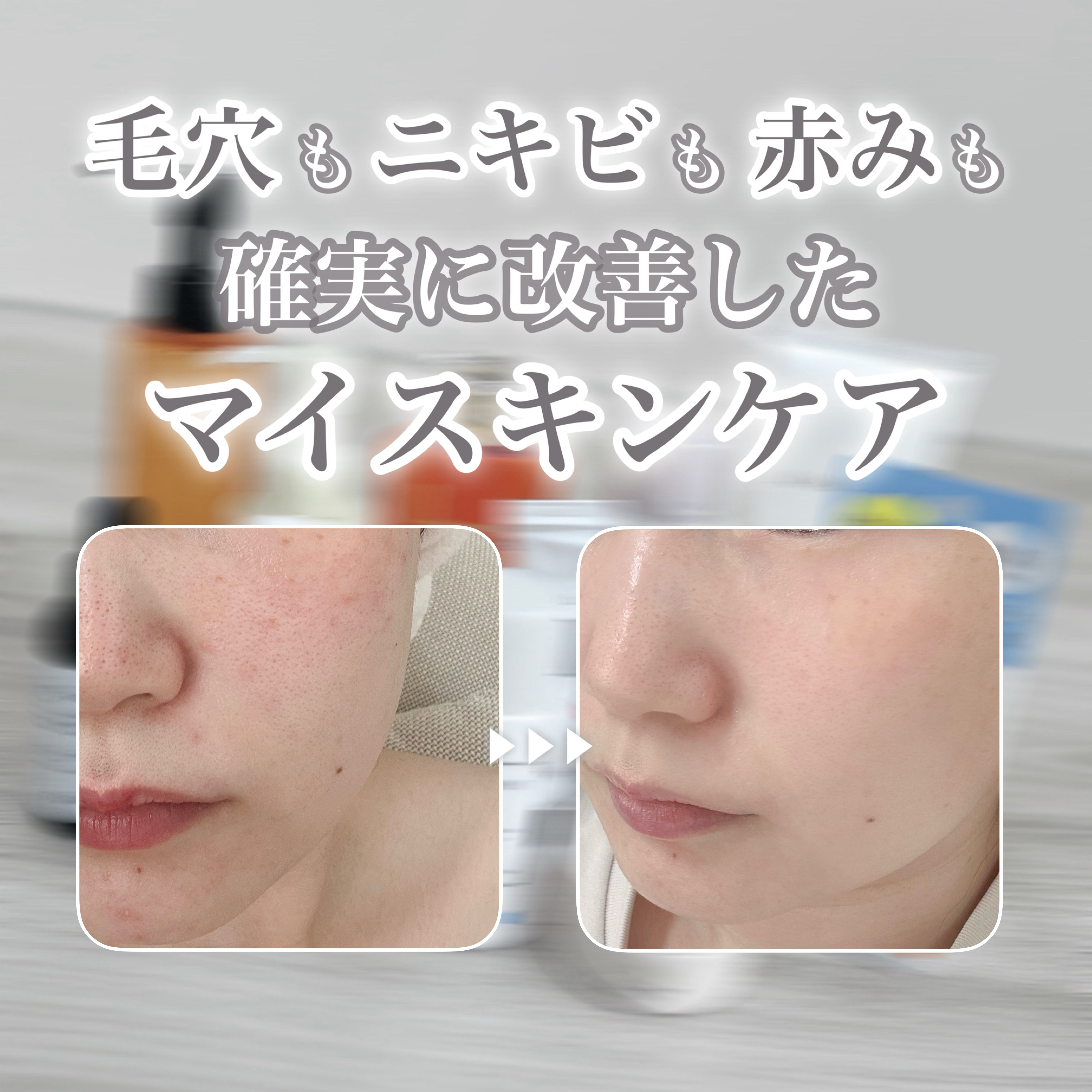 オバジC 酵素洗顔パウダー/オバジ/洗顔パウダーを使ったクチコミ（1枚目）