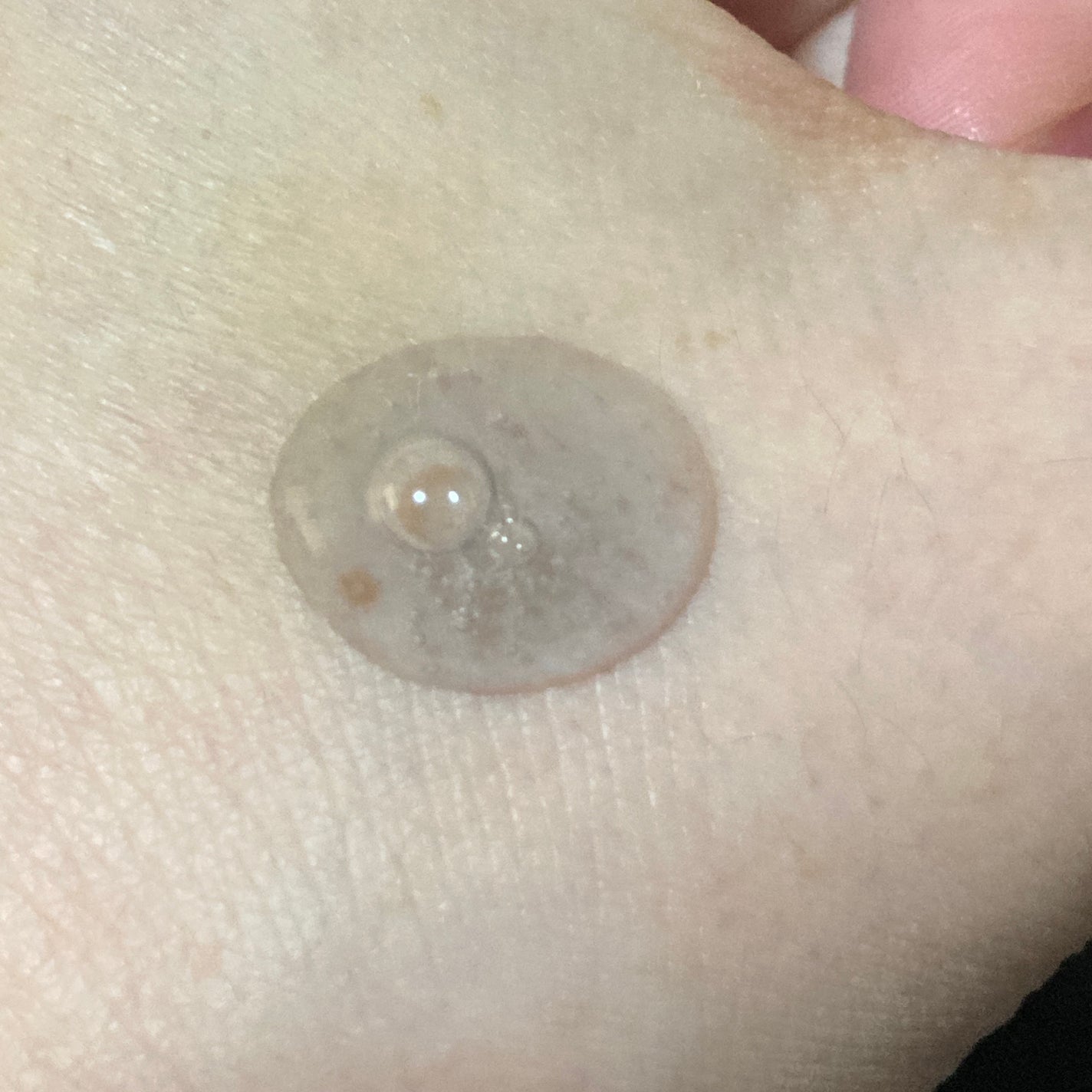 ブラックPDRN 美容液/ネイチャーリパブリック/美容液を使ったクチコミ(3枚目)