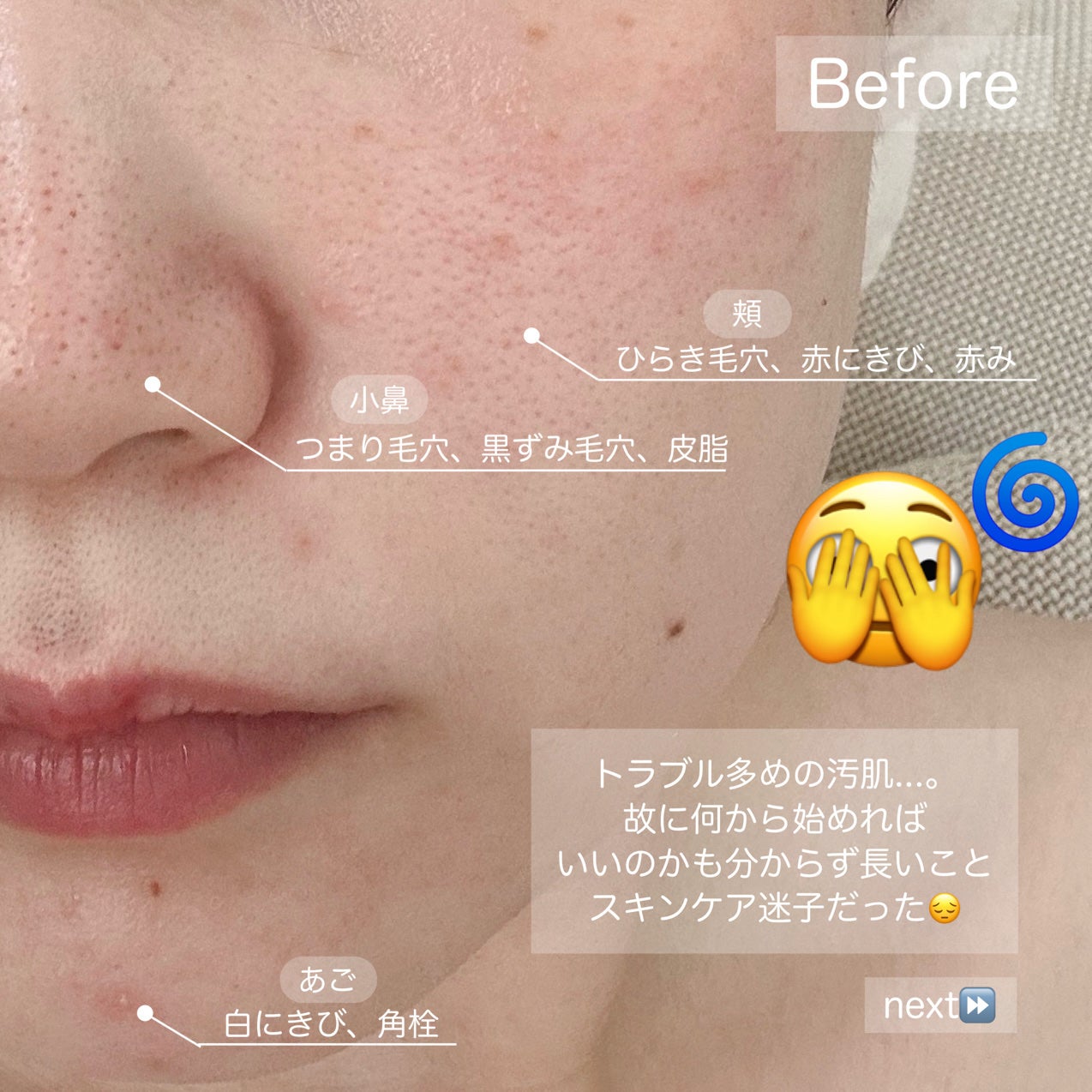 オバジC 酵素洗顔パウダー/オバジ/洗顔パウダーを使ったクチコミ(2枚目)