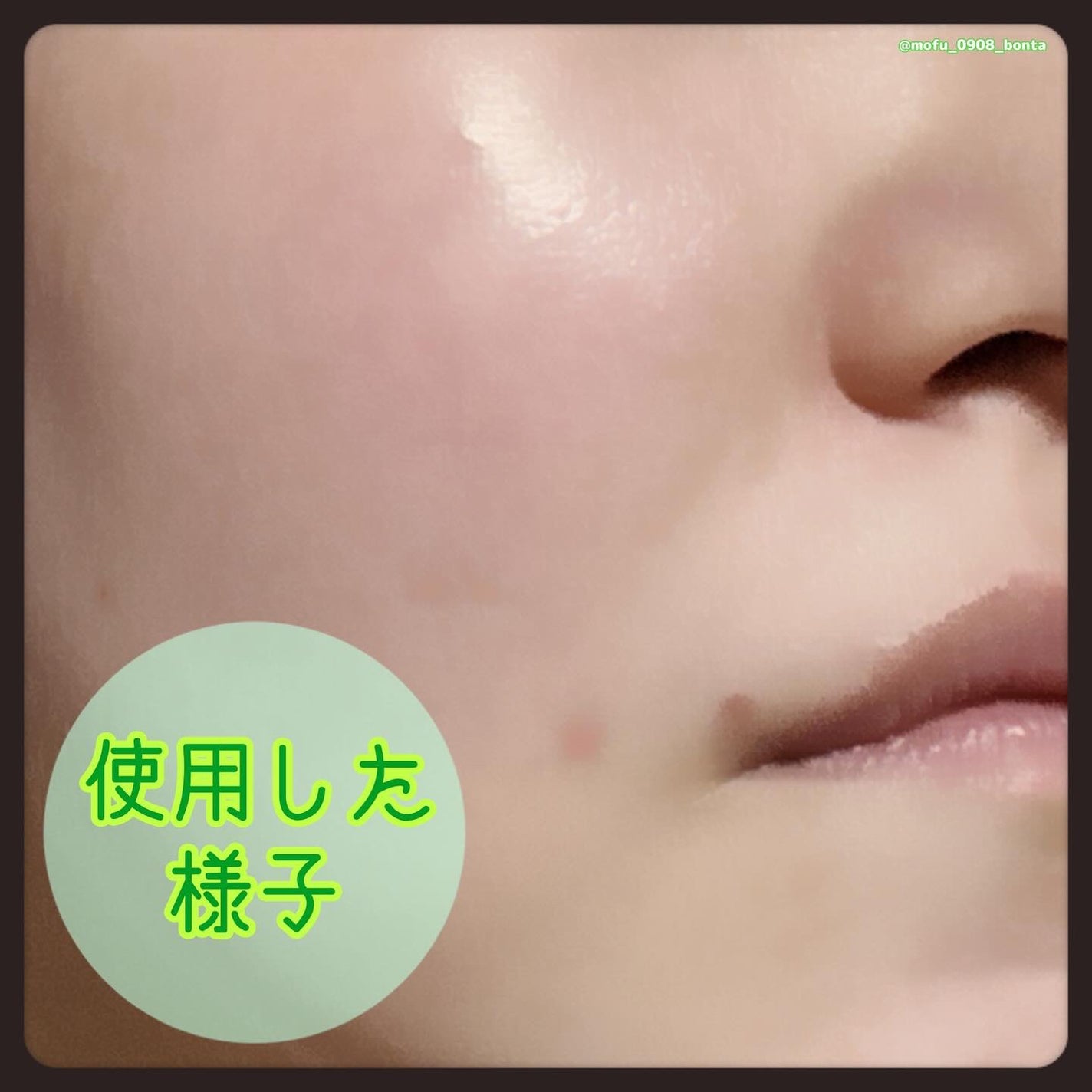 トラブルコントロールパッド/EIOM/トナーパッドを使ったクチコミ(6枚目)