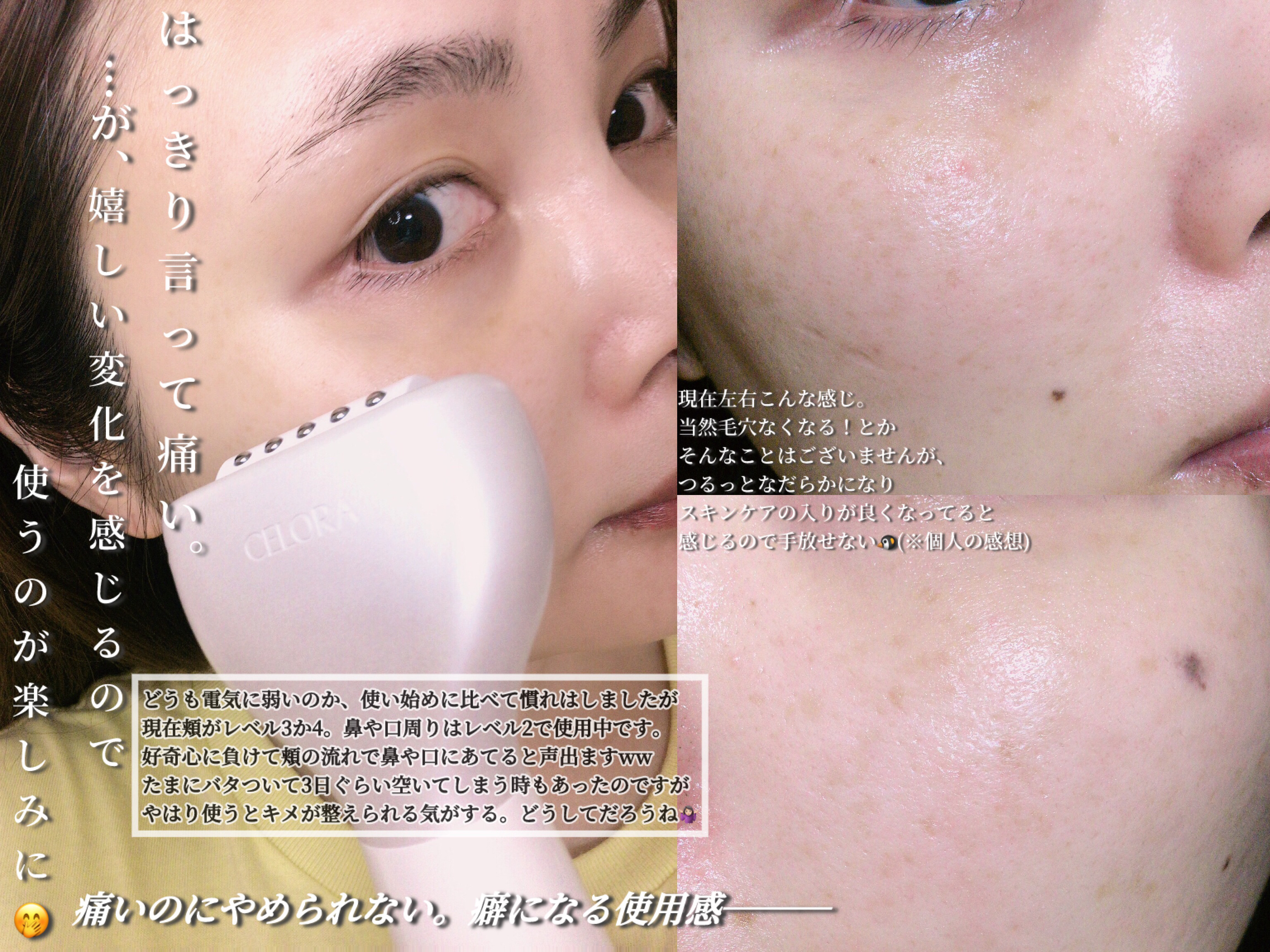 ペンタショット/CELORABY/美顔器・マッサージを使ったクチコミ（2枚目）