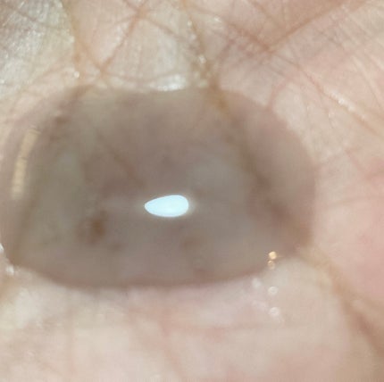 ブラックPDRN 美容液/ネイチャーリパブリック/美容液を使ったクチコミ(4枚目)