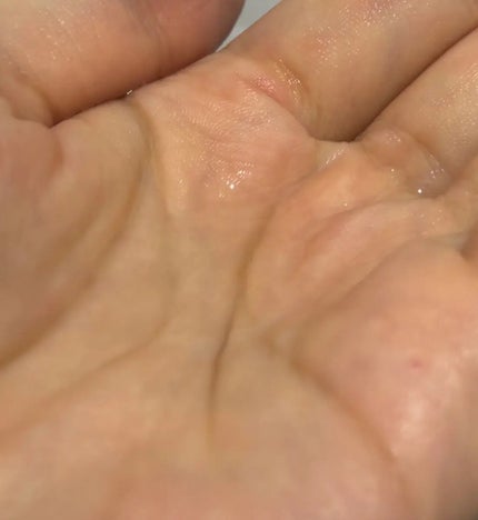 フォルテ アンプル トリートメント/treecell/洗い流すヘアトリートメントを使ったクチコミ(4枚目)