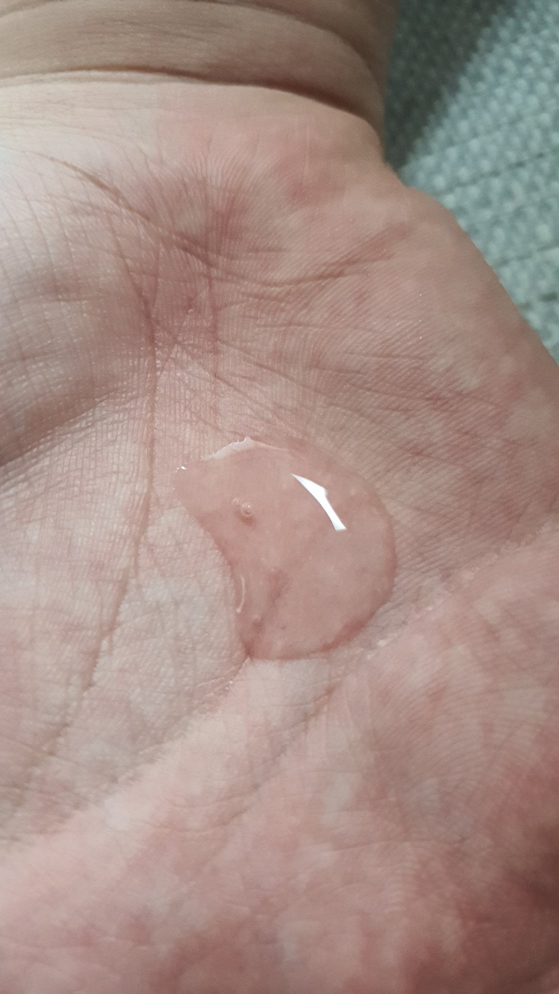 シークレットソリューションPDRNカプセルアンプル/It's skin/美容液を使ったクチコミ(4枚目)