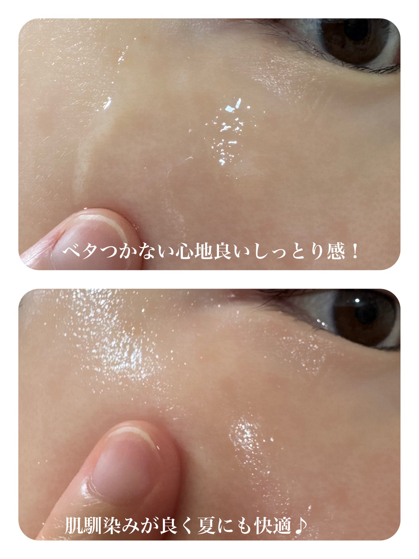 ☆scallop☆フォロバ100%☆ on LIPS 「\混合肌・脂性肌さんの“困った”に寄り添うセラム🌿/梅雨〜夏の..」(4枚目)