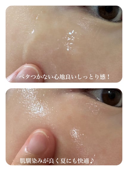 ☆scallop☆フォロバ100%☆ on LIPS 「\混合肌・脂性肌さんの“困った”に寄り添うセラム🌿/梅雨〜夏の..」(4枚目)