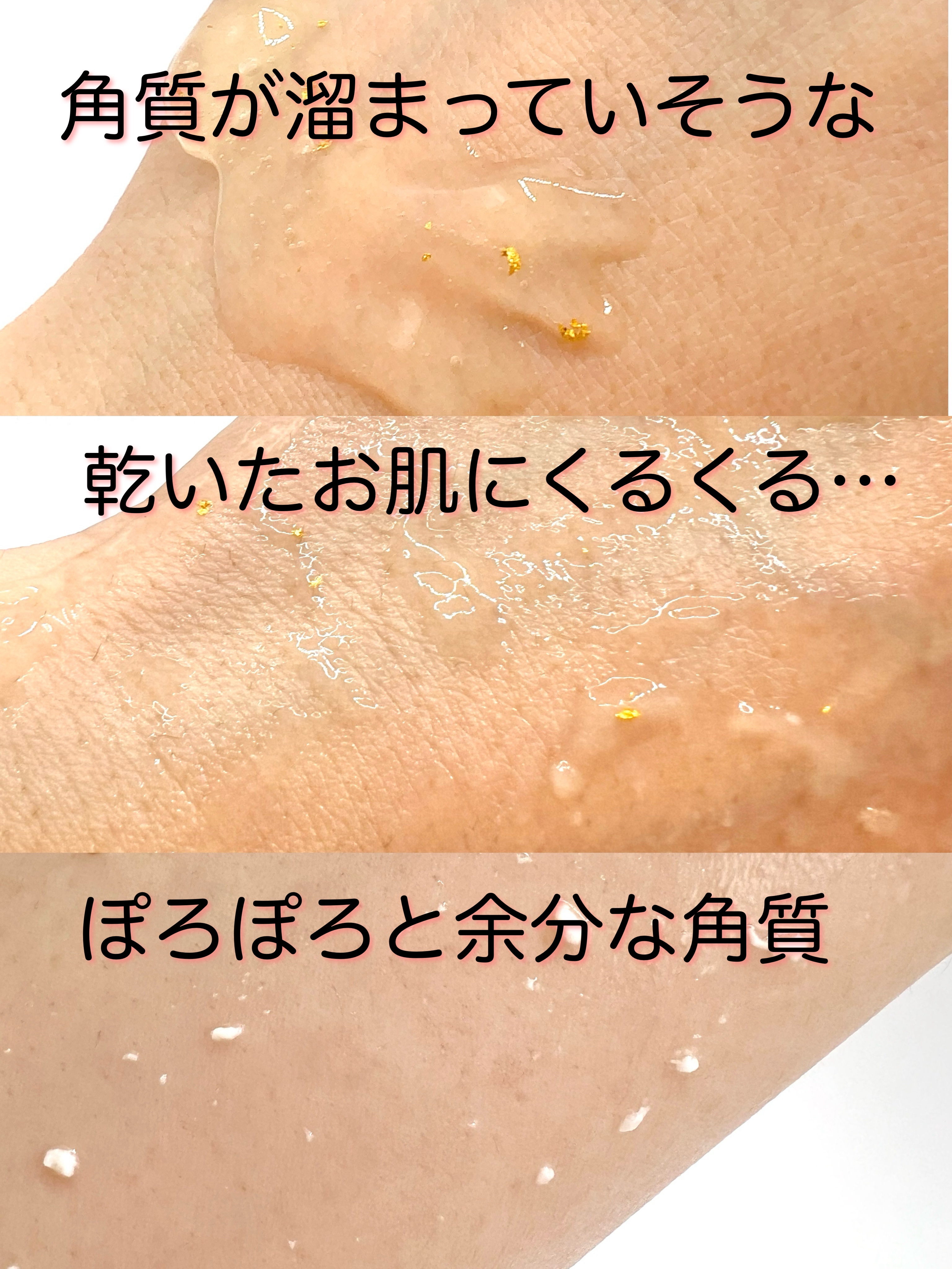 エステファクト GDピーリングジェル/たかの友梨エステファクト/ピーリングを使ったクチコミ（2枚目）