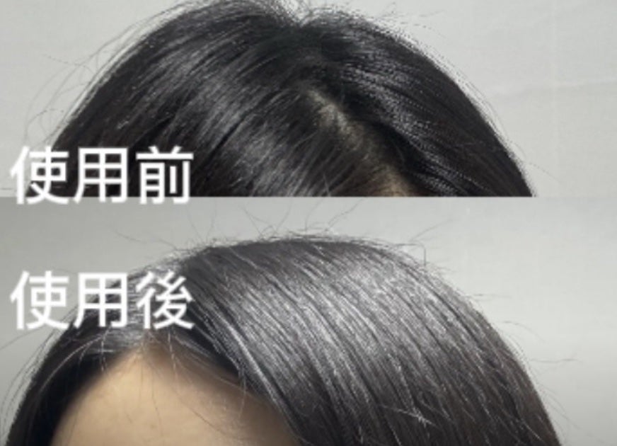 フォルテ アンプル トリートメント/treecell/洗い流すヘアトリートメントを使ったクチコミ(5枚目)