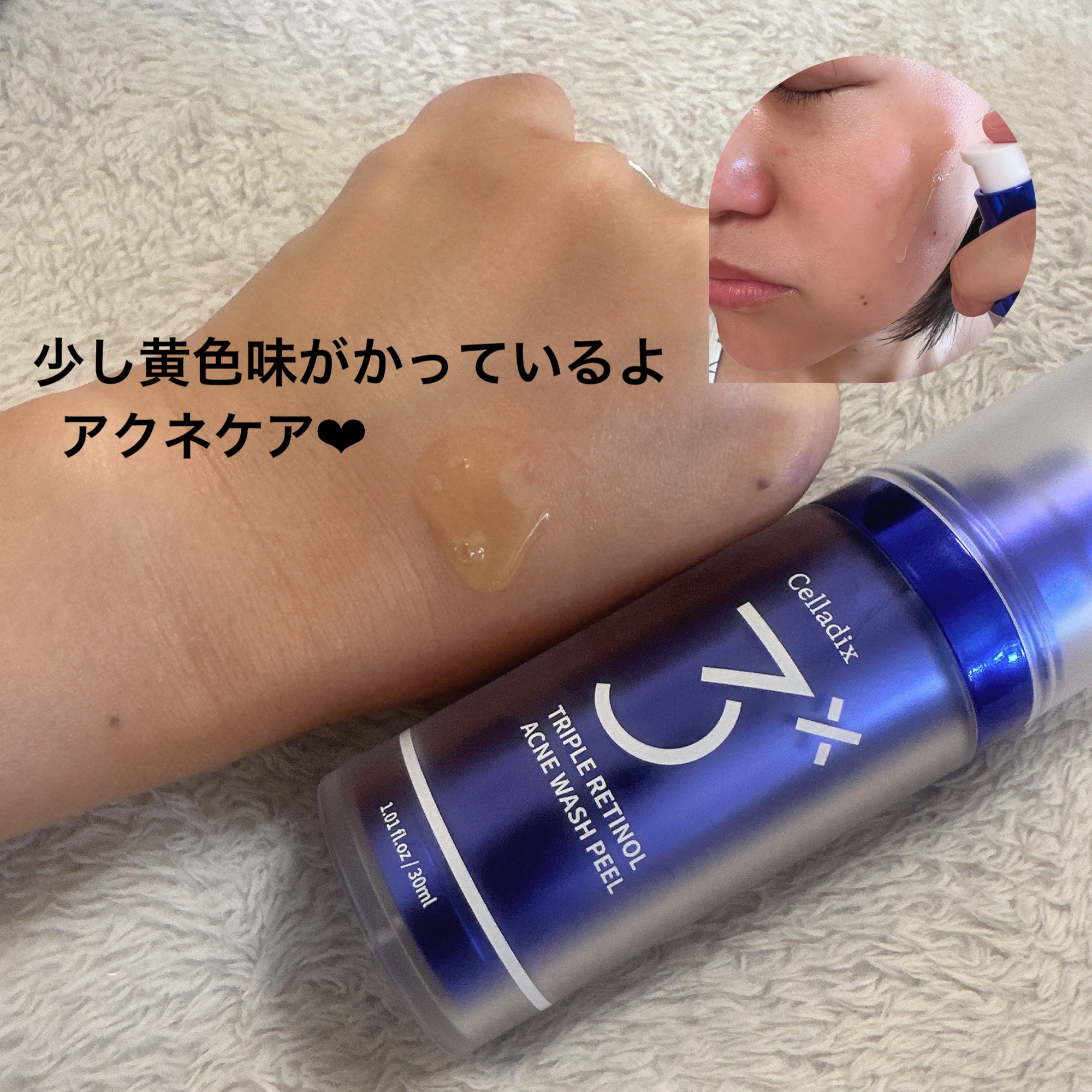 トリプル レチノール ウォッシュピール/Celladix/ピーリングを使ったクチコミ（2枚目）