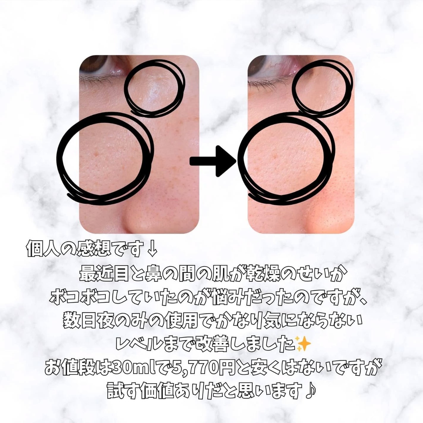 NMN-PDRN ダーマアンサー ポア ファーミング アンプル/CNP Laboratory/美容液を使ったクチコミ(3枚目)