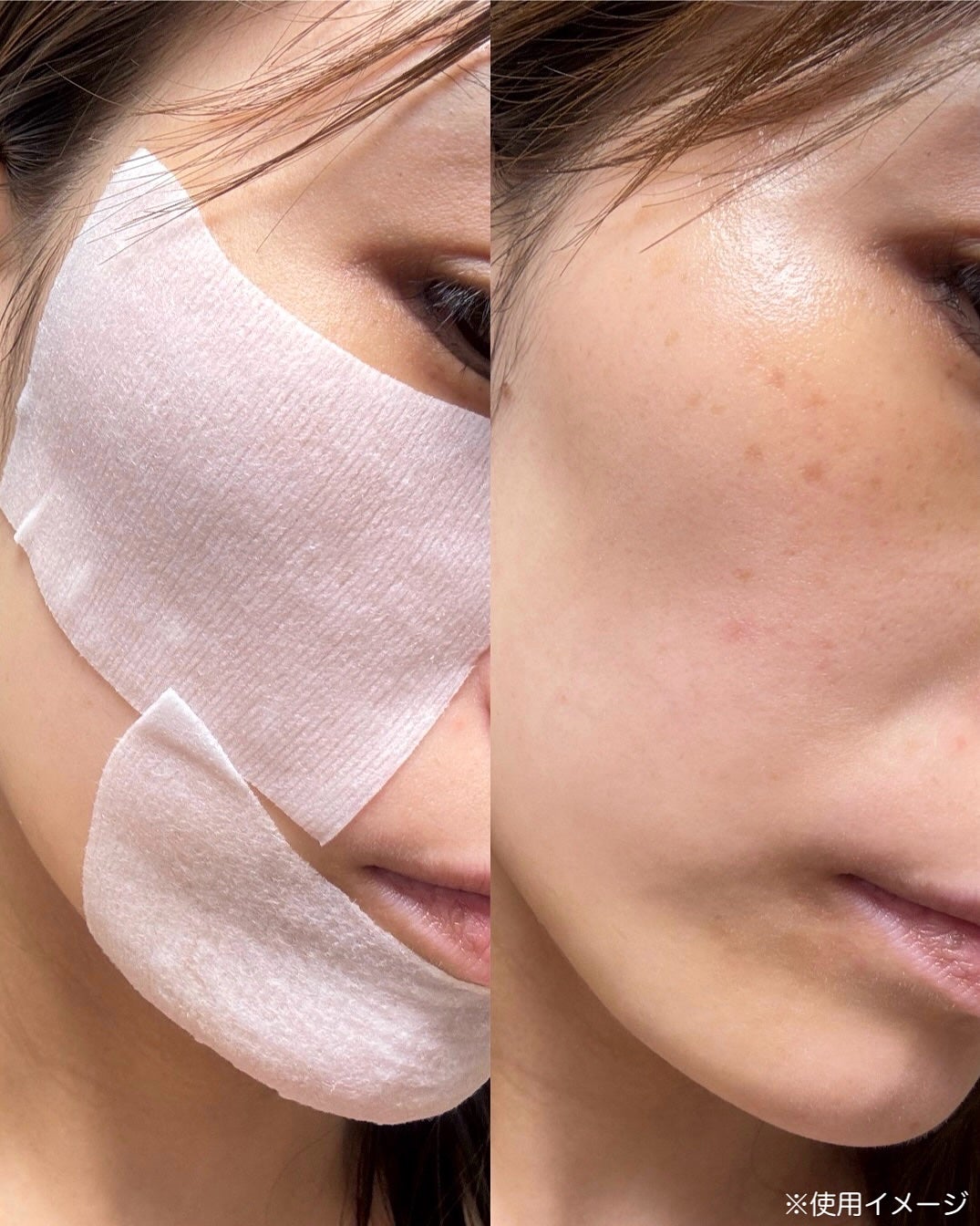 スージングリペア トーニングパッド/ダーマファーム/トナーパッドを使ったクチコミ(6枚目)