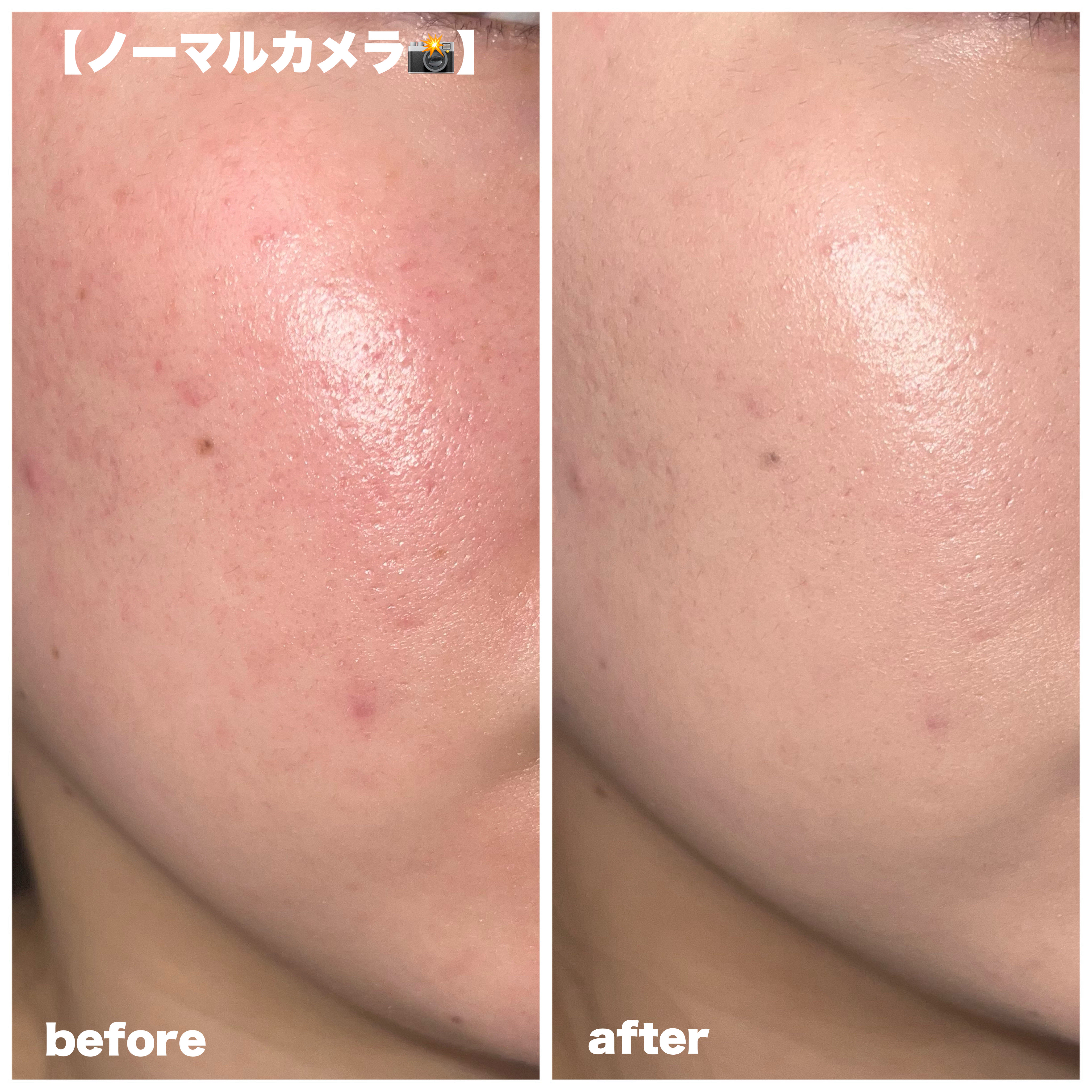 シカマヌ 92セラム/parnell/美容液を使ったクチコミ（3枚目）