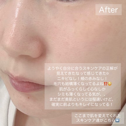 オバジC 酵素洗顔パウダー/オバジ/洗顔パウダーを使ったクチコミ(3枚目)