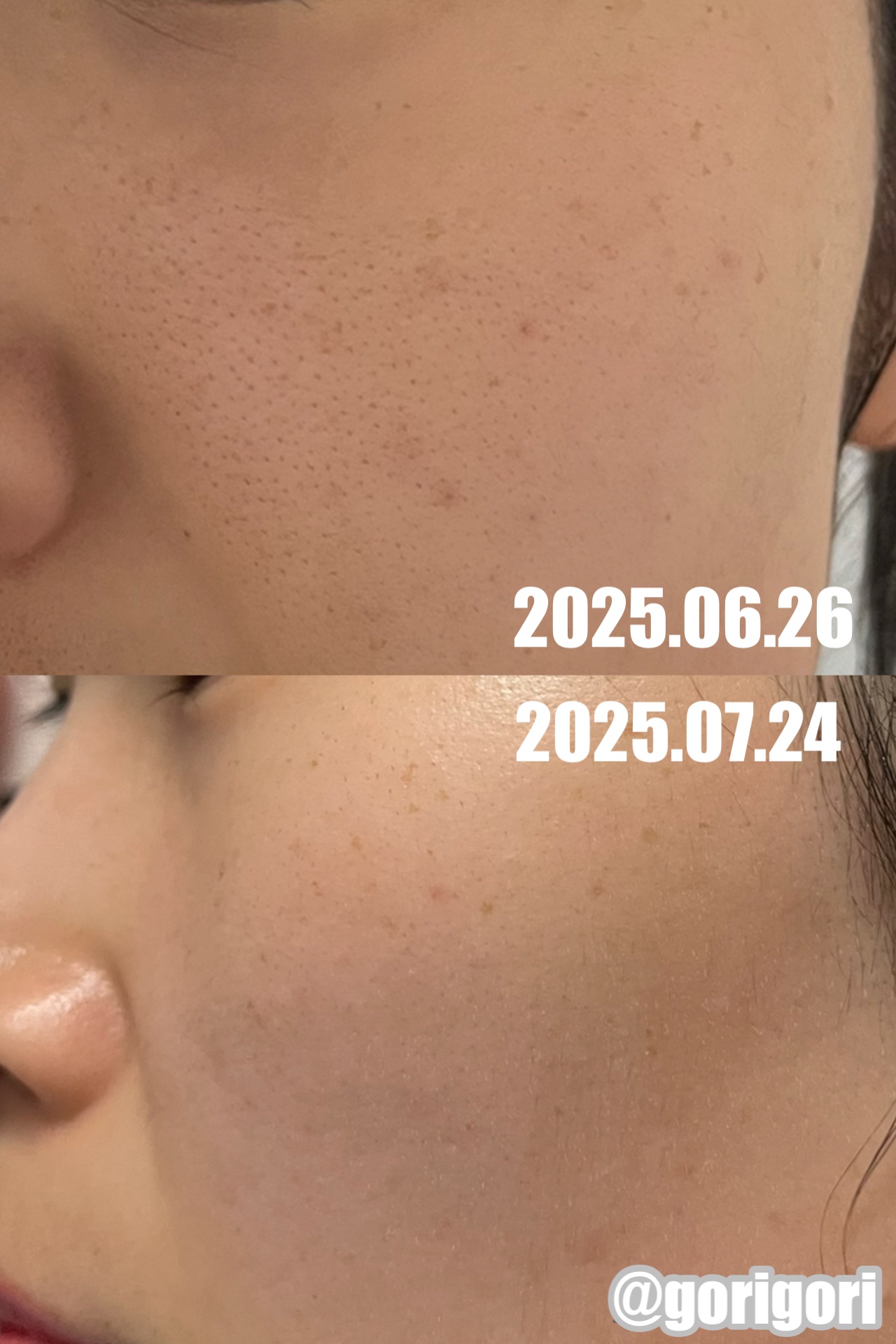 キテン リポソームビタミンC サプリメント 2000mg/KITEN/美容サプリメントを使ったクチコミ（3枚目）