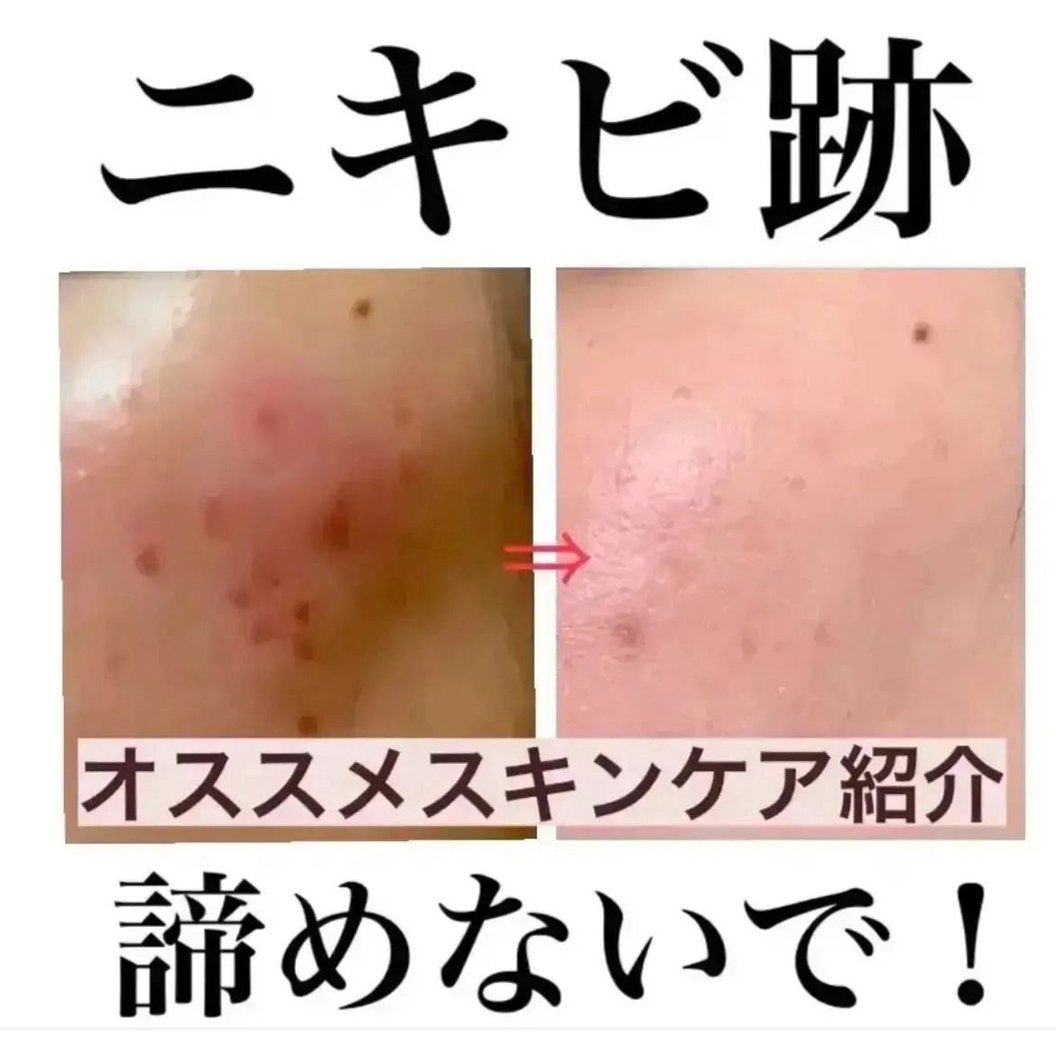 肌が綺麗になったスキンケアアイテム紹介✨

✼••┈┈••✼••┈┈••✼••┈┈••✼••┈┈••✼

♡オルビスクリアフル ローションLさっぱりタイプ

いちばんのオススメ！

値段もプチプラで手を出しやすいし、ノンコメ