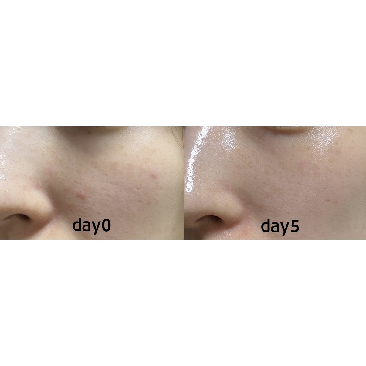 オーズナリージェットブルーセラム/オーズナリー/美容液を使ったクチコミ（2枚目）