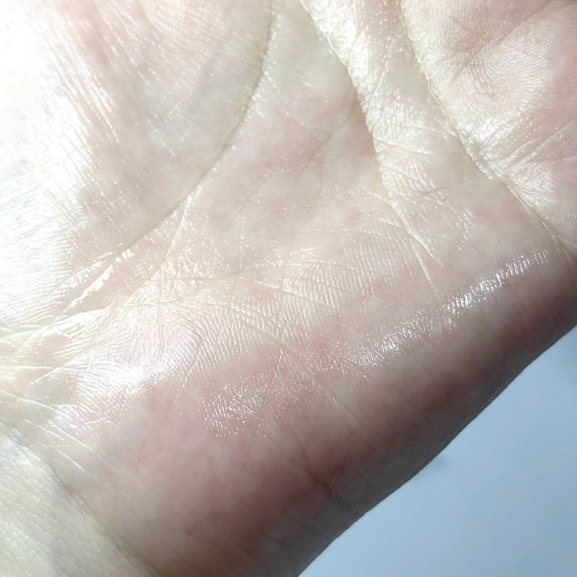 バイオームレメディポアリセットPDRN セラム/UIQ/美容液を使ったクチコミ(6枚目)