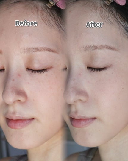 スポットメンテパウダー/muice/プレストパウダーを使ったクチコミ(5枚目)