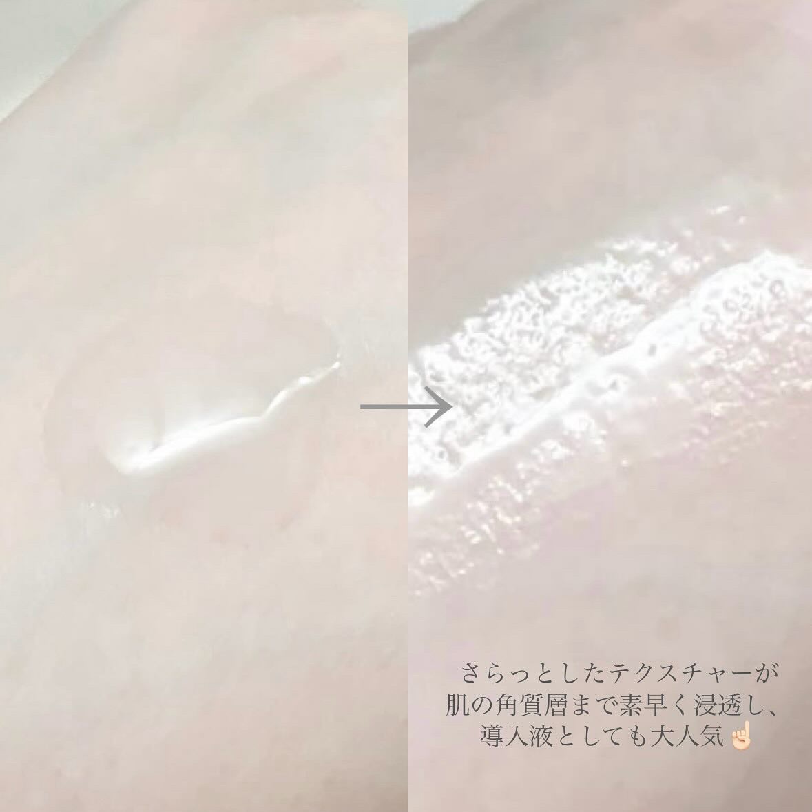 ガラク ナイアシン 3.0 エッセンス/manyo/美容液を使ったクチコミ（3枚目）