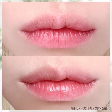 トリートメントリップバーム/CEZANNE/口紅・グロス・リップライナー・リップケアを使ったクチコミ(5枚目)