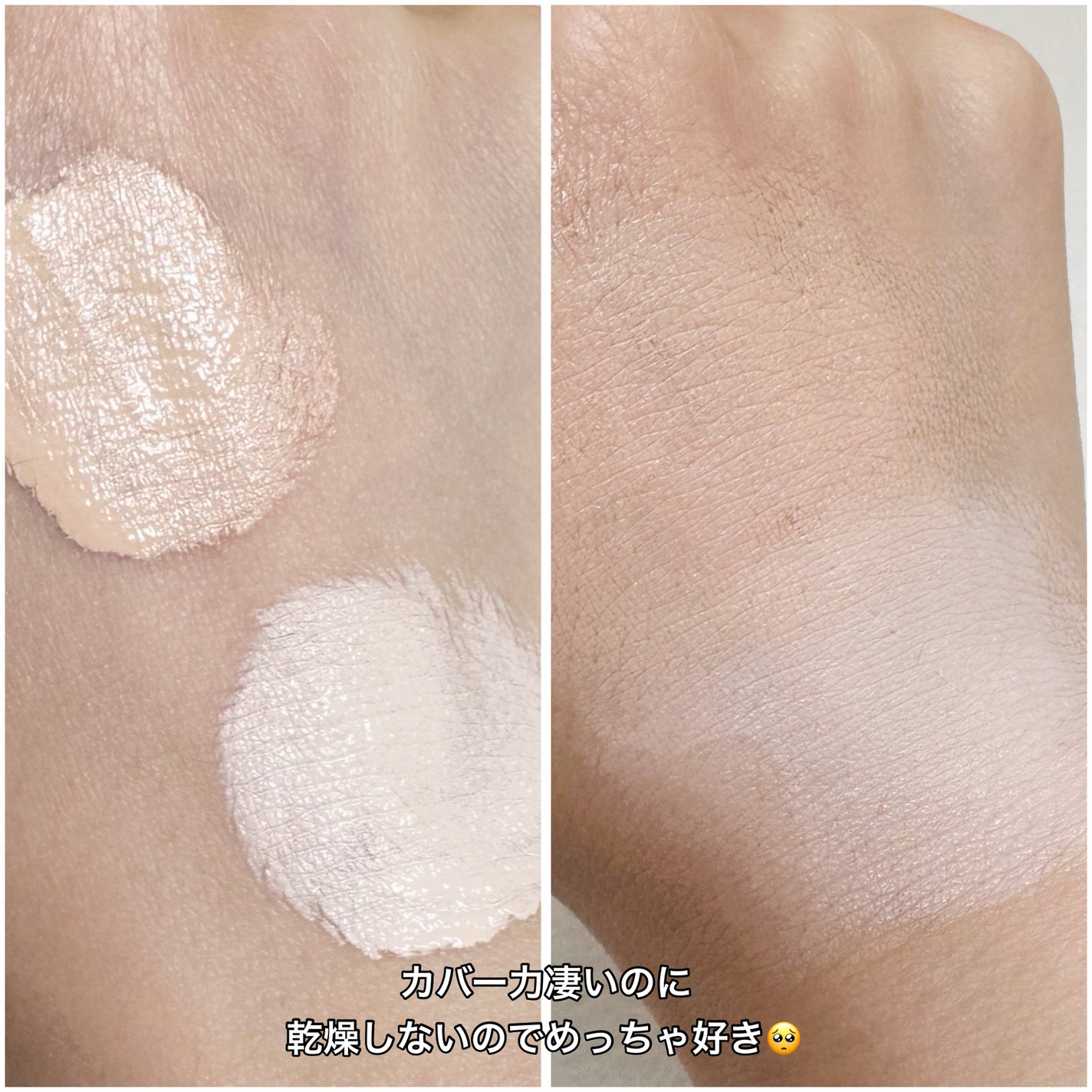 ダーマシンコンシーラー/23years old/リキッドコンシーラーを使ったクチコミ(3枚目)