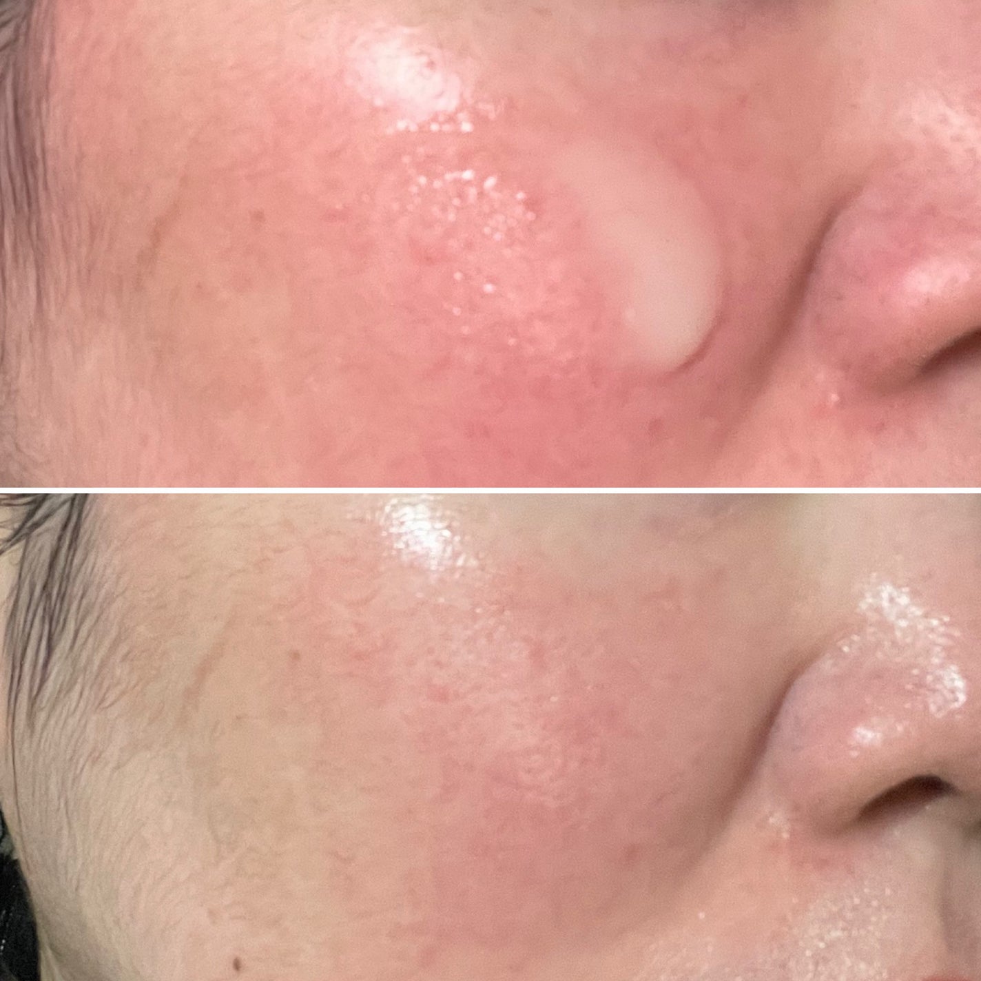 Skin Barrier Calming Lotion/Ongredients/乳液を使ったクチコミ(4枚目)